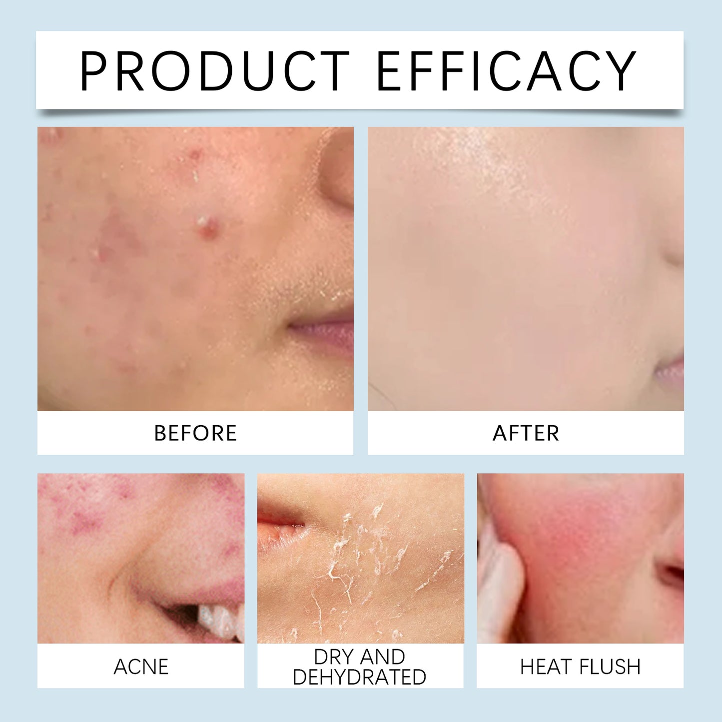 Hoygi Hyaluronic Acid Roller Serum Facial skin radiance improvement pore hydration