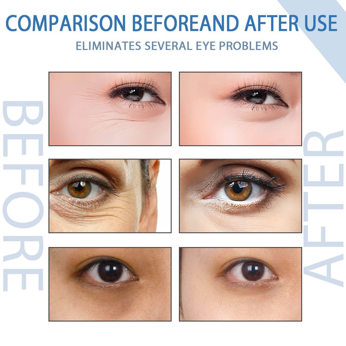 Hoygi Eye essence Reduce Dark Circles, Moisturize, Smooth, and Firm Eye Area Skin, Hydrating and Nourishing Eye Serum