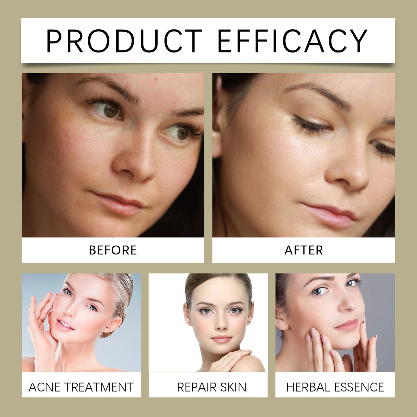 OUHOE Glycolic acid7%Moisturizing Toner,Remove Closed Comedones, Improve Skin Condition, Rejuvenate and Refresh Skin Essence