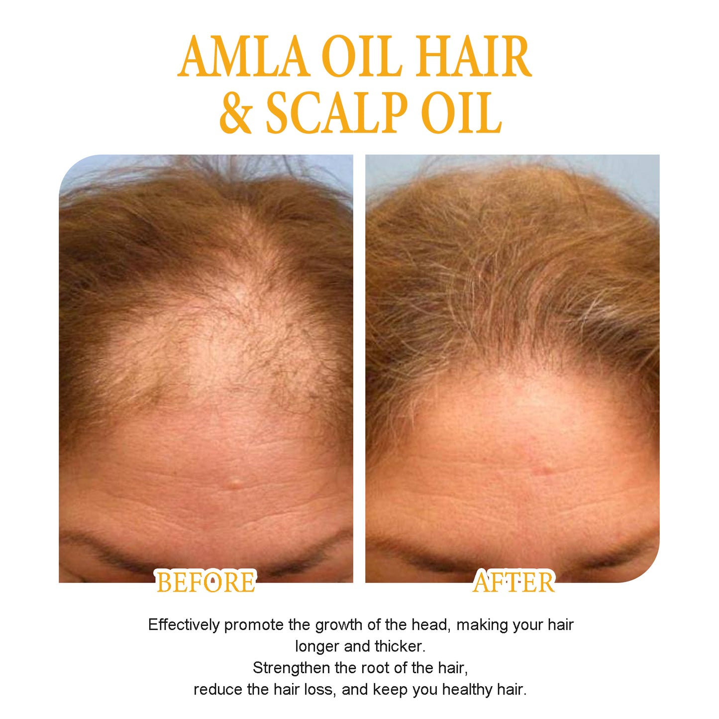 OUHOE Biotin Hair Thickening Spray Nourishing Hair Roots Repairing Dry and Frizzy Hair Anti-Hair Loss Thickening Spray