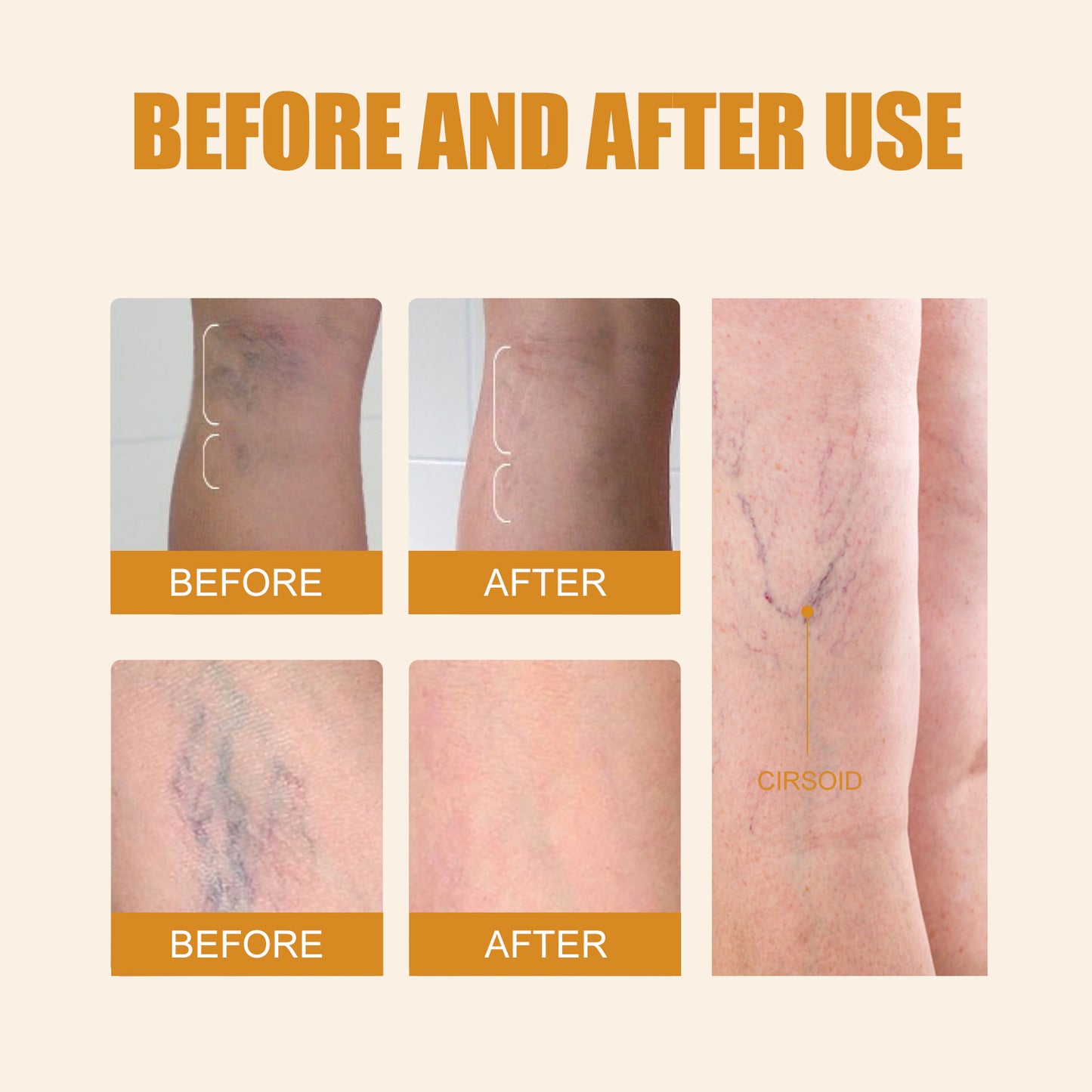 Ximonth Leg Repair Pen Relieve Leg Bulge Discomfort Leg Massage Care Body Repair Pen