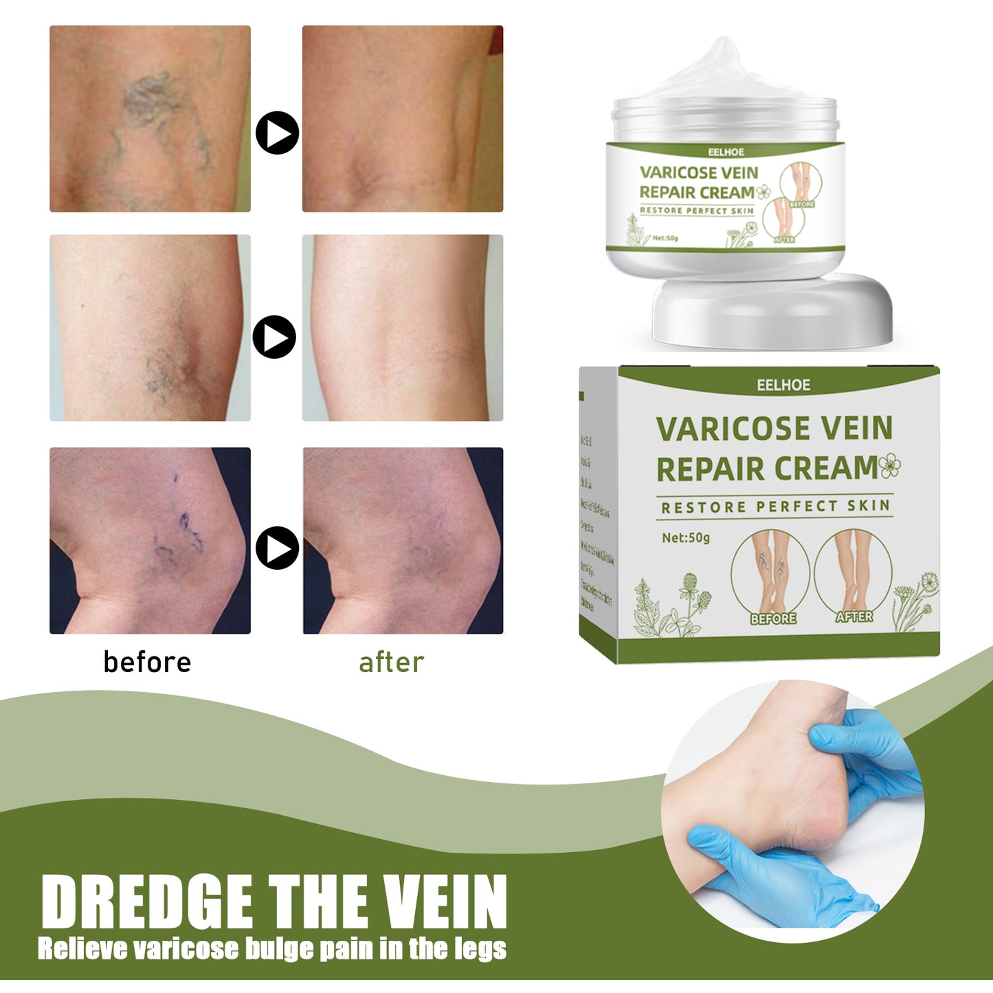 EELHOE Leg Repair Cream Relieve Leg Discomfort Massage Leg Vein Protrusion Pulse Health Repair Cream