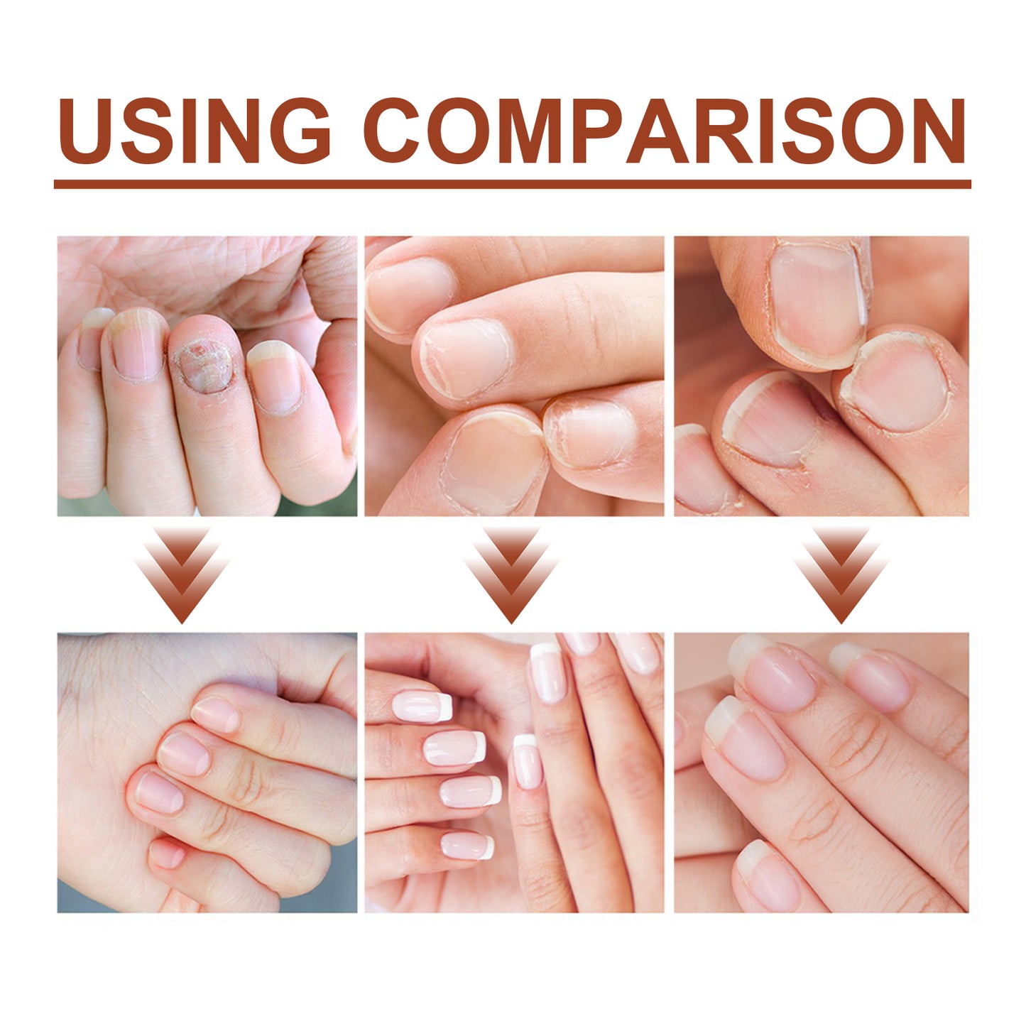 Jaysuing 7Nail Care Essence Onychomycosis Hand and Foot Nail Nutritional Cleansing Care Essence