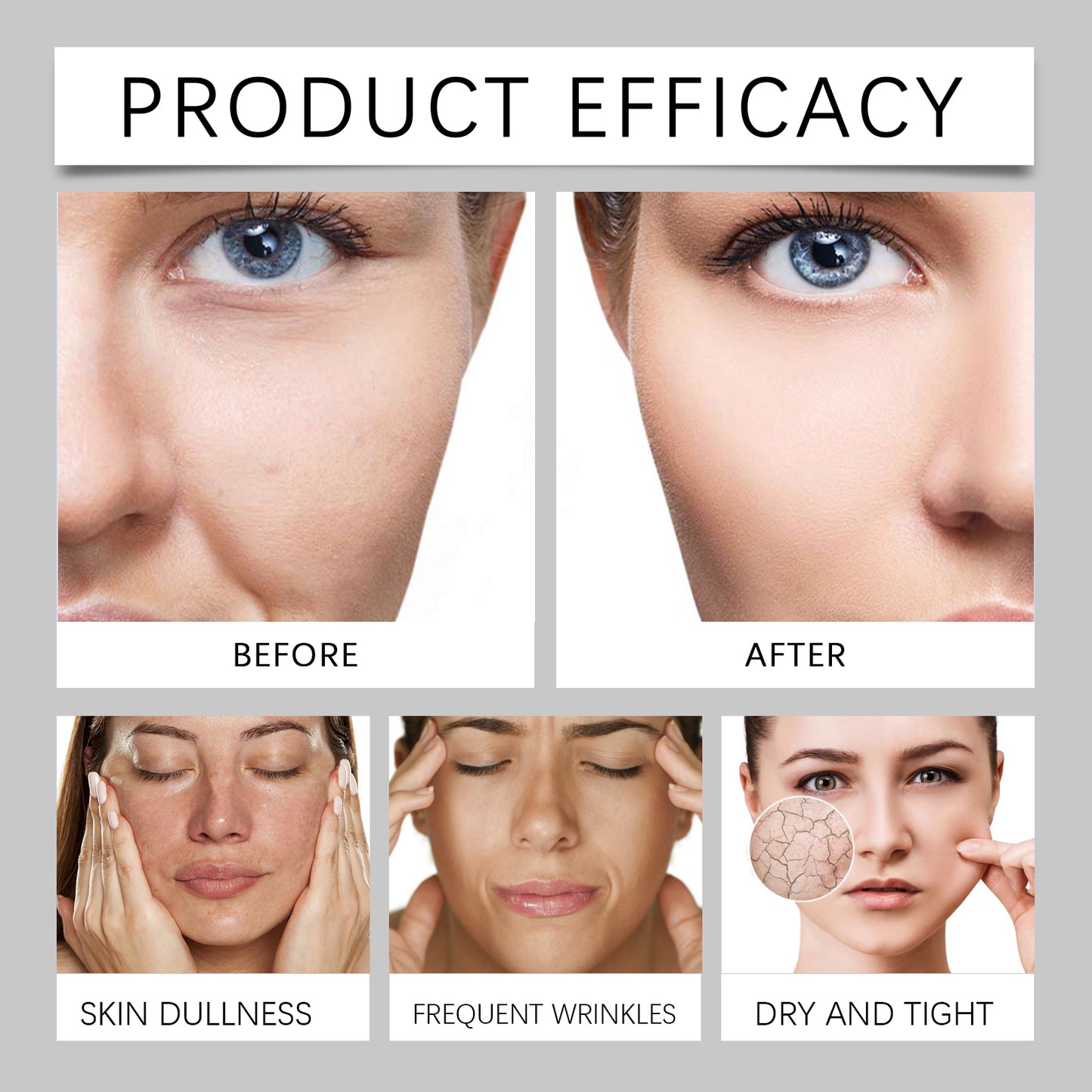 ximonth Bee Venom Anti-Wrinkle Firming Cream Facial skin moisturizing and hydrating cream for reducing fine lines and lifting skin tone