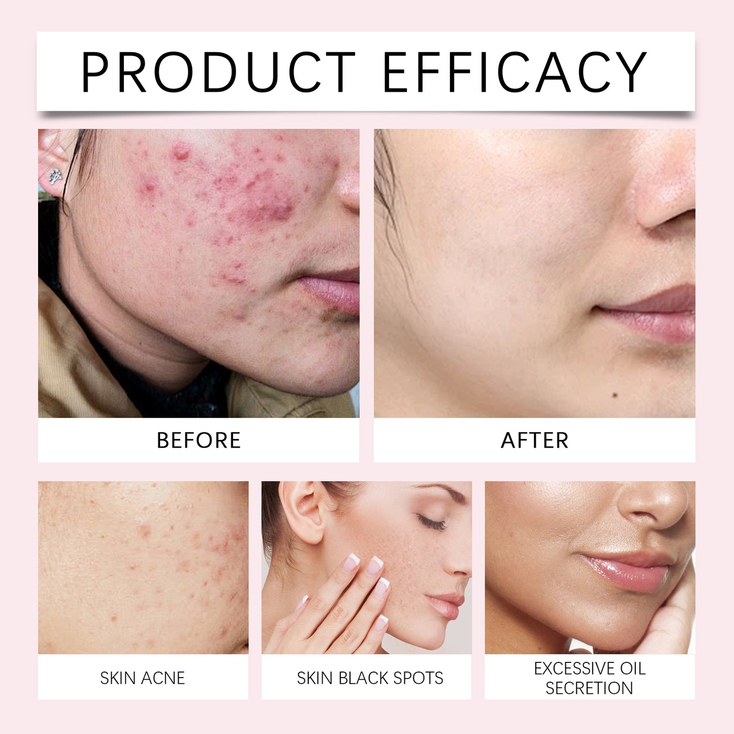 EELHOE Turmeric Kojic Acid Cleansing Pad Gentle cleansing skincare reduces acne, brightens the face, and refines pores