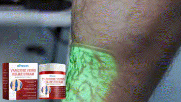 Ximonth Vein Repair Cream Leg Massage Relieve Leg Swelling Earthworm Leg Skin Body Massage Cream