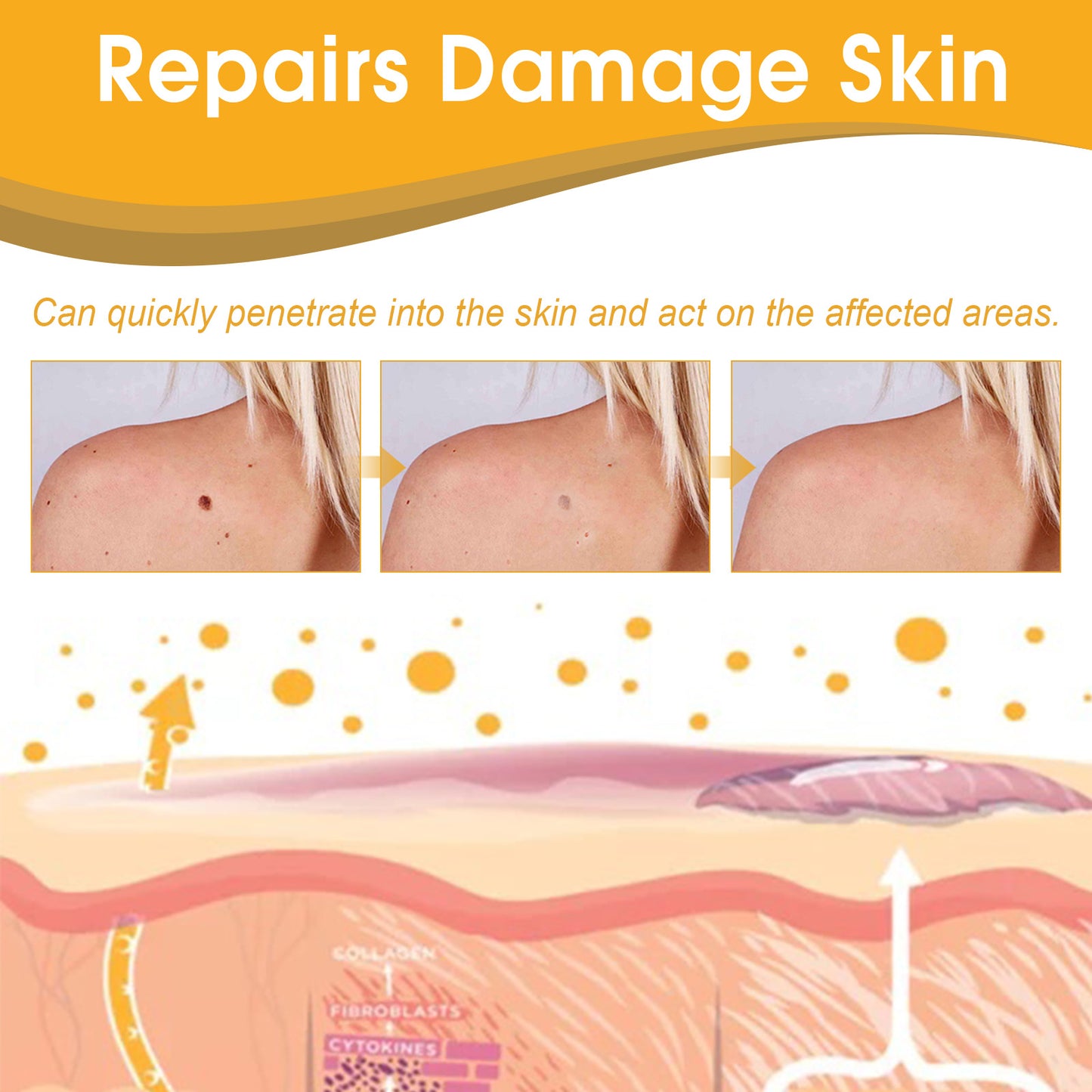 Ximonth Bee Venom Wart Care Spray Improve Skin Texture, Repair Moles, Smooth Skin, Wart Removal Spray