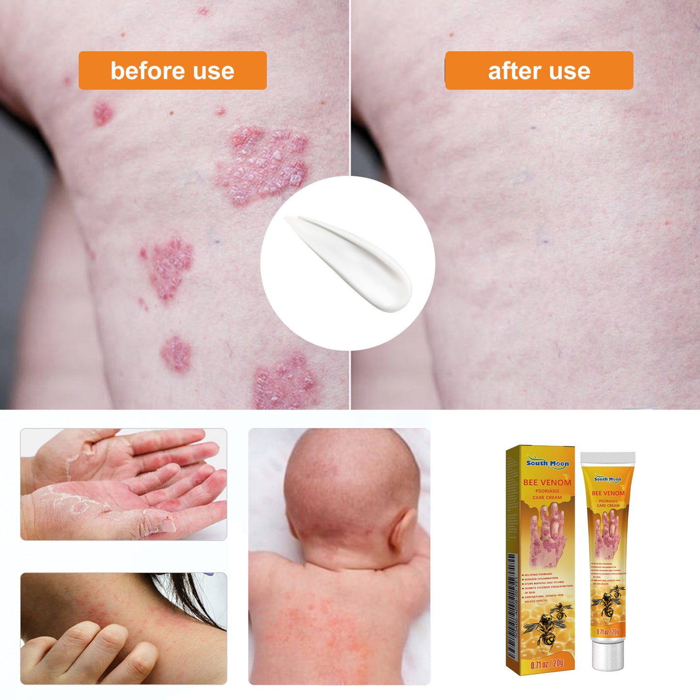 South Moon Skin Repair Cream Relieve itchy skin, repair hand and foot fungus, moisturize skin care cream