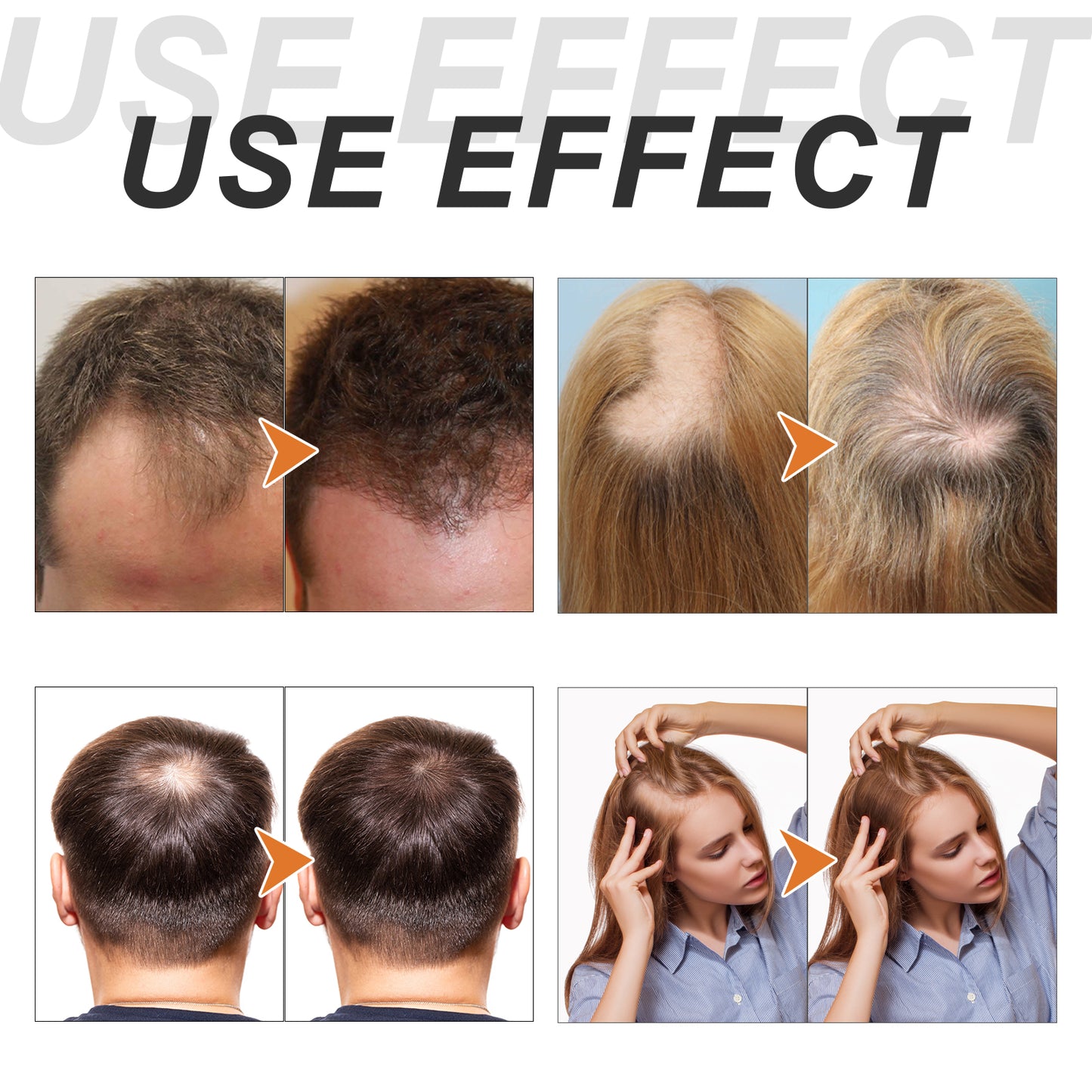 OUHOE Onion Biotin Rosemary Shampoo Set Nourish hair roots and scalp for dense, shiny, and thick hair