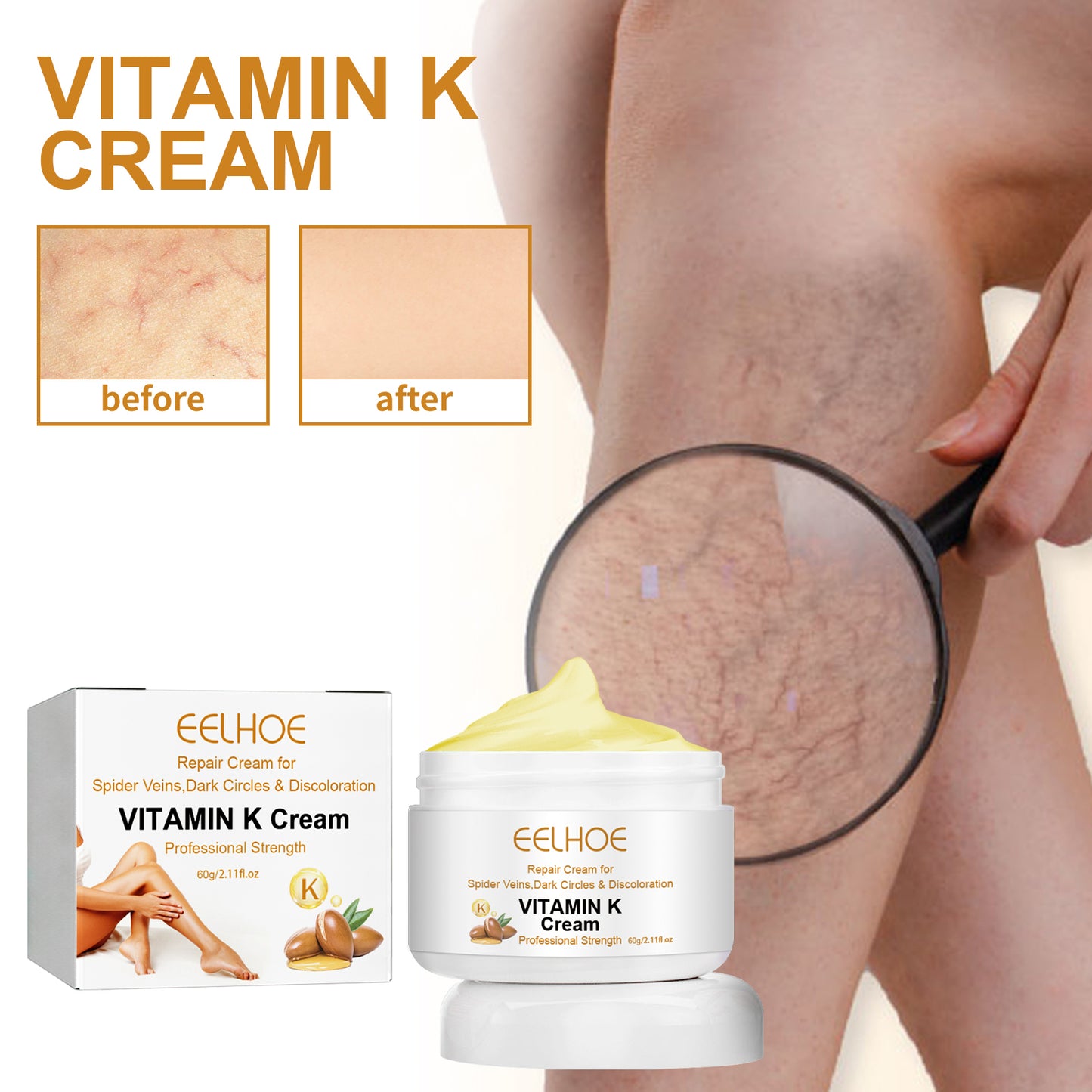 EELHOE Vitamin k Frost Skin Care Relieve Leg Soreness Swelling Earthworm Leg Vein Massage Care Cream