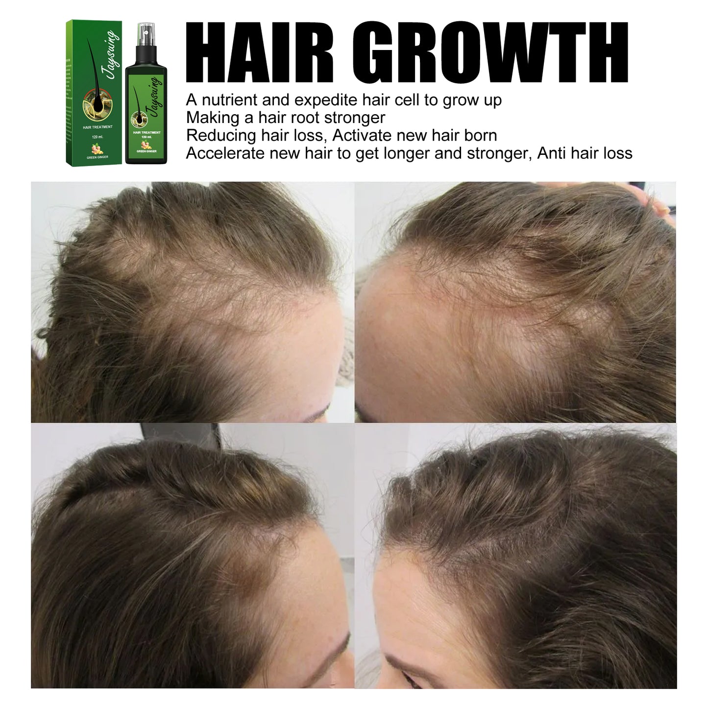 Jaysuing Hair Care Solution Gentle Nourishing Massage Scalp Moisturizing Smooth Hair Care Spray