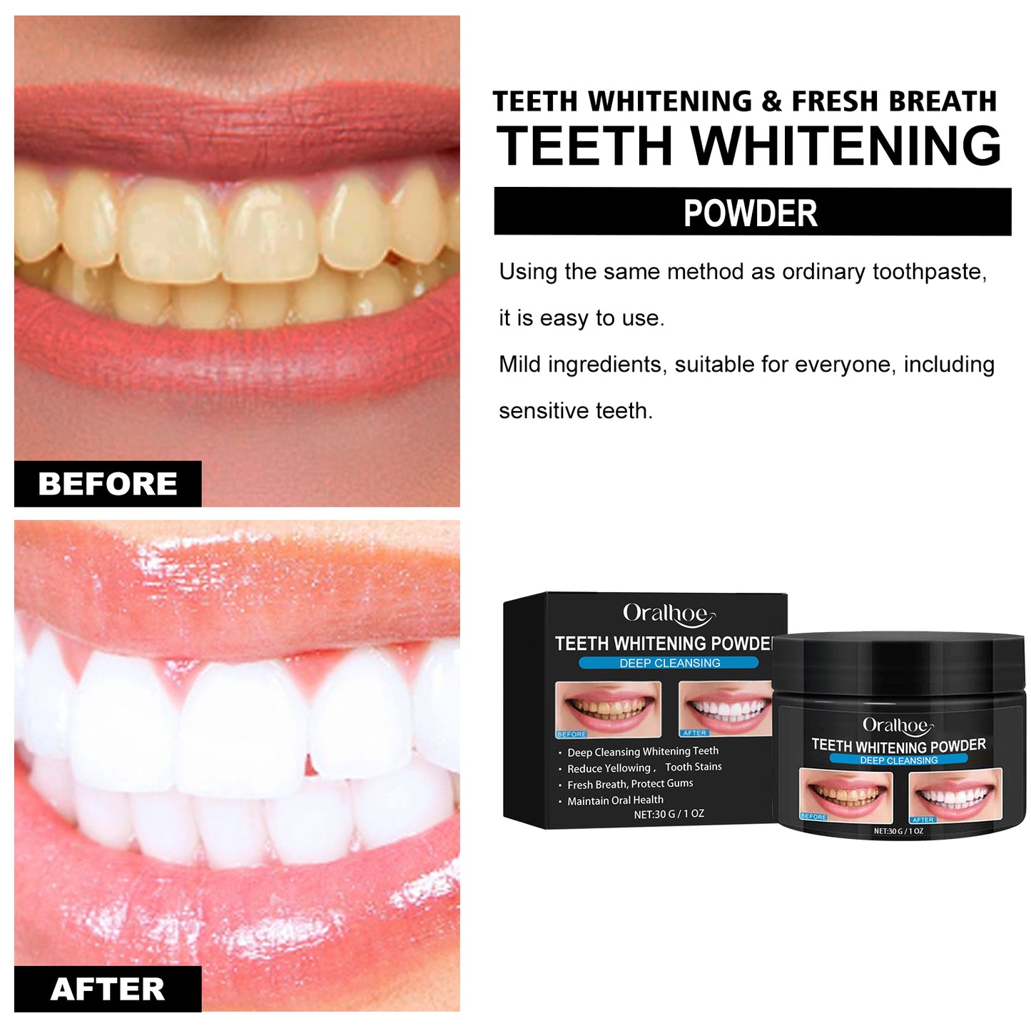 Oralhoe Activated Carbon Teeth Whitening Powder Teeth Whitening, Teeth Cleaning, Tartar Removal, Yellow Teeth, Smoke Teeth, Oral Care