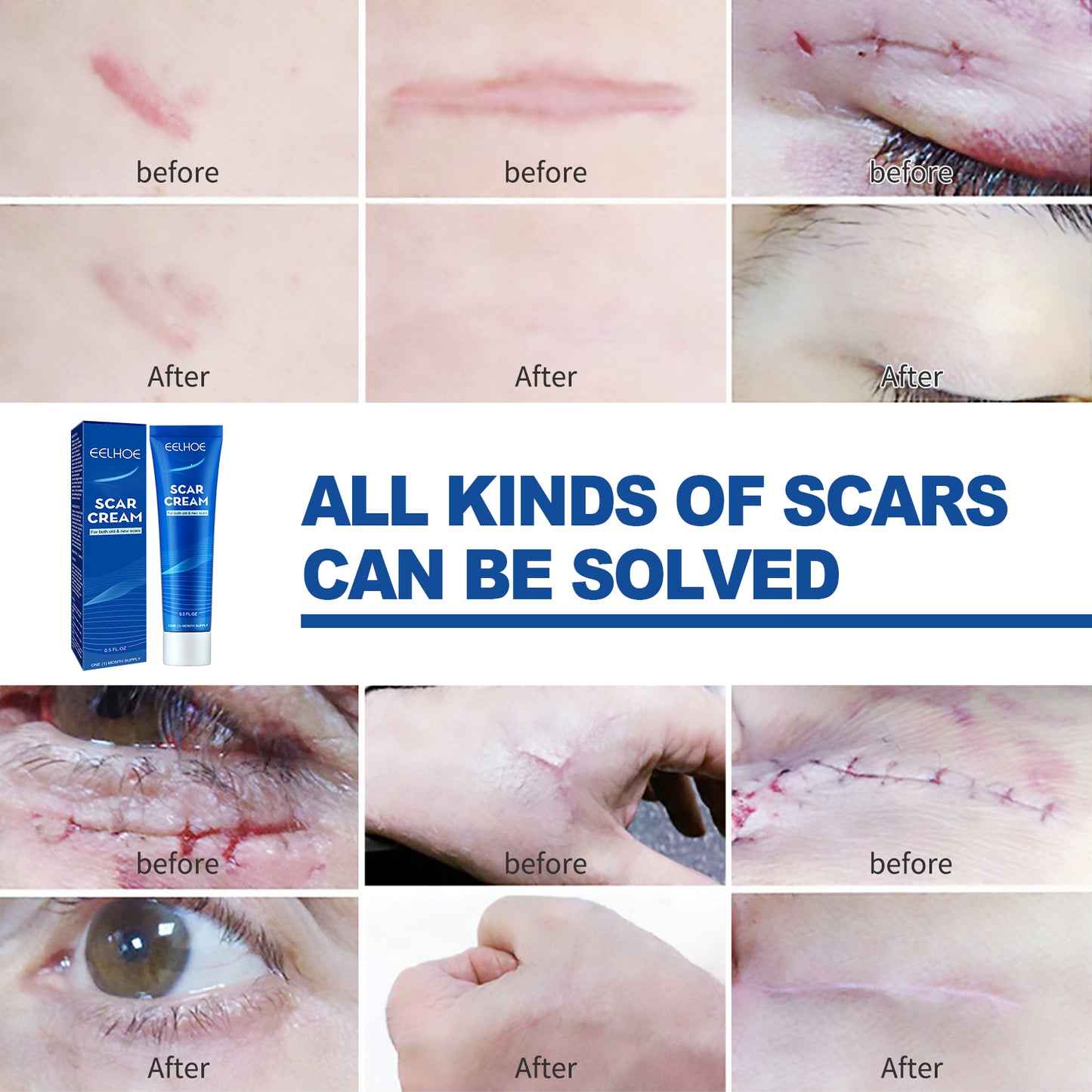 EELHOE Skin Care Cream Gentle Care External Body Care Moisturizing Smoothing Skin Care Application Cream