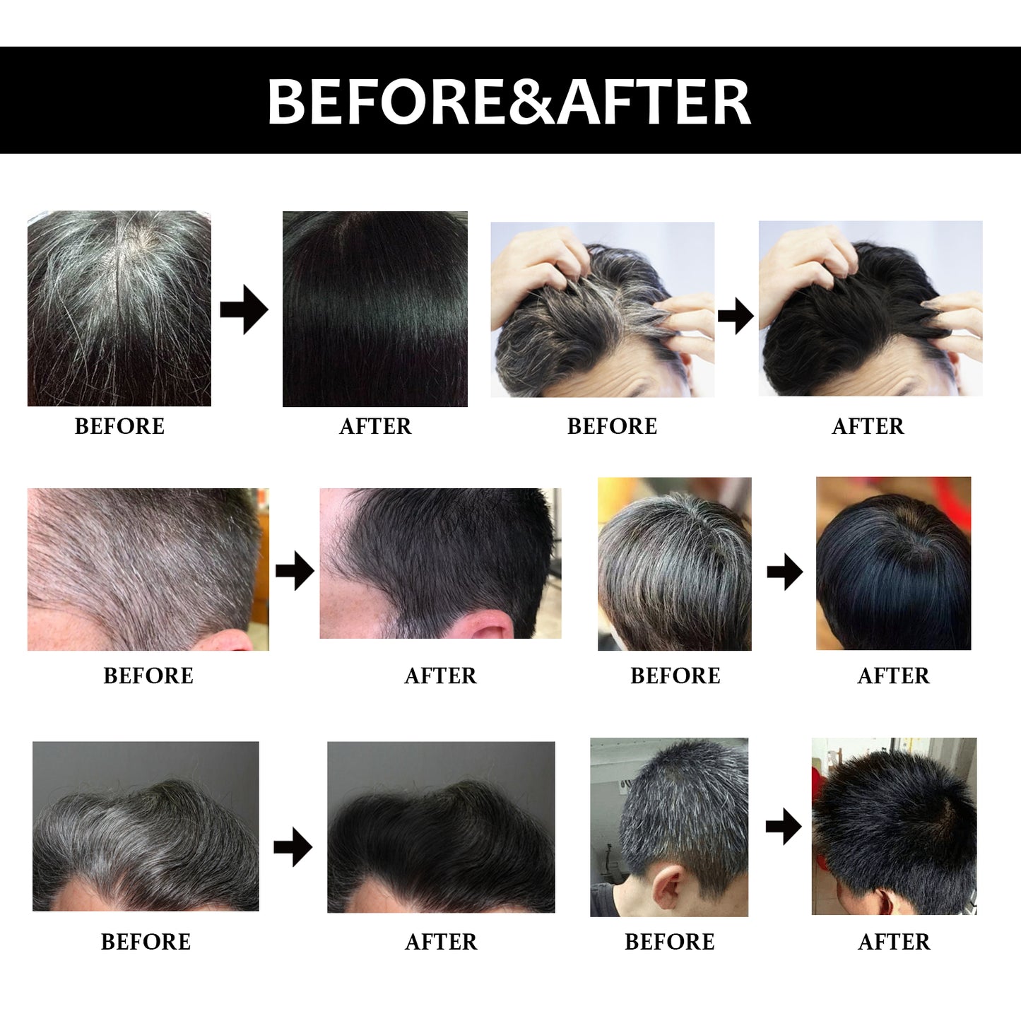 East Moon Black Hair Soap Hair nourishing, moisturizing, cleansing, smoothing hair roots, naturally black and thick hair care shampoo soap