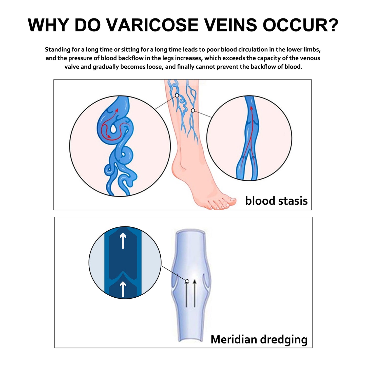 EELHOE Leg Repair Cream Relieve Leg Discomfort Massage Leg Vein Protrusion Pulse Health Repair Cream