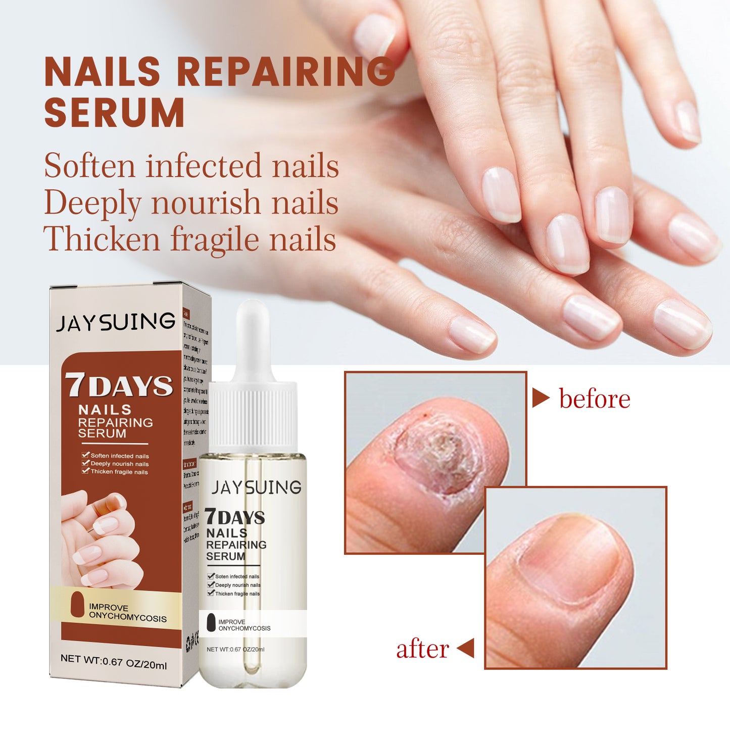 Jaysuing 7Nail Care Essence Onychomycosis Hand and Foot Nail Nutritional Cleansing Care Essence