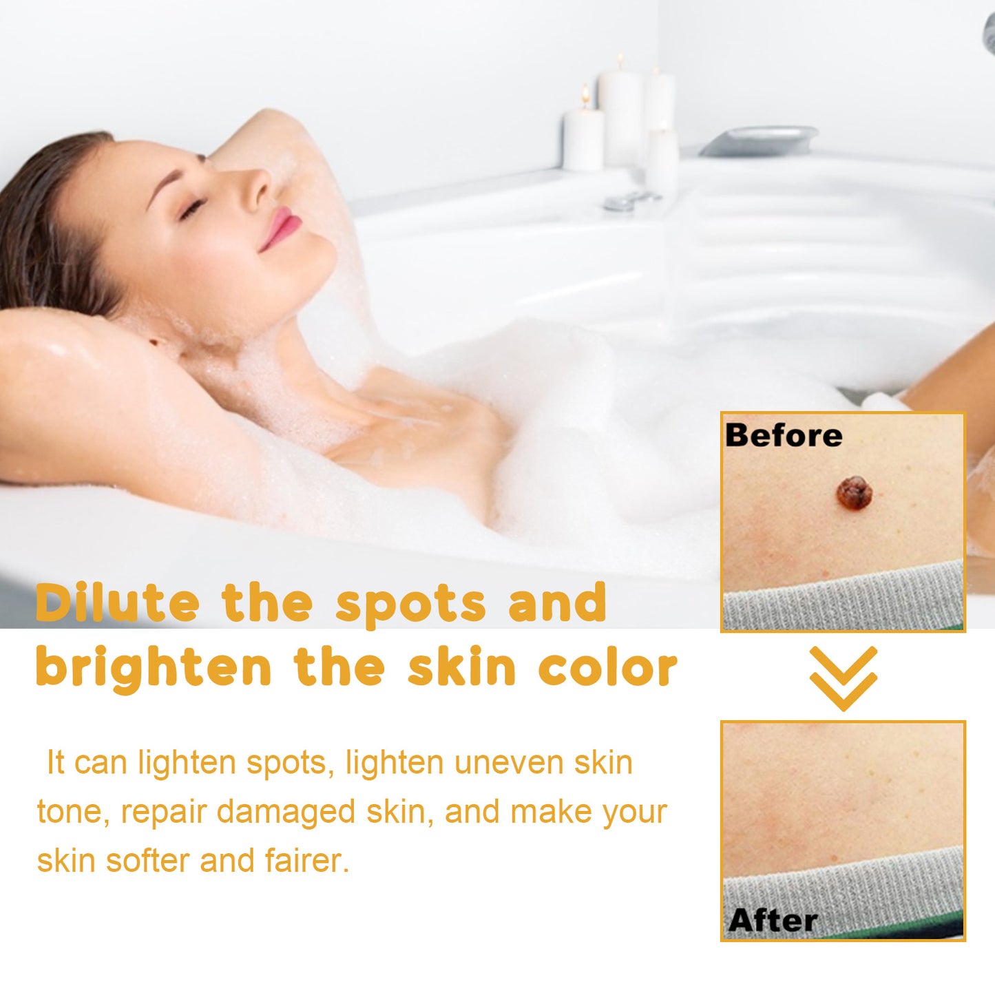 Ximonth Bee Venom Wart Care Spray Improve Skin Texture, Repair Moles, Smooth Skin, Wart Removal Spray