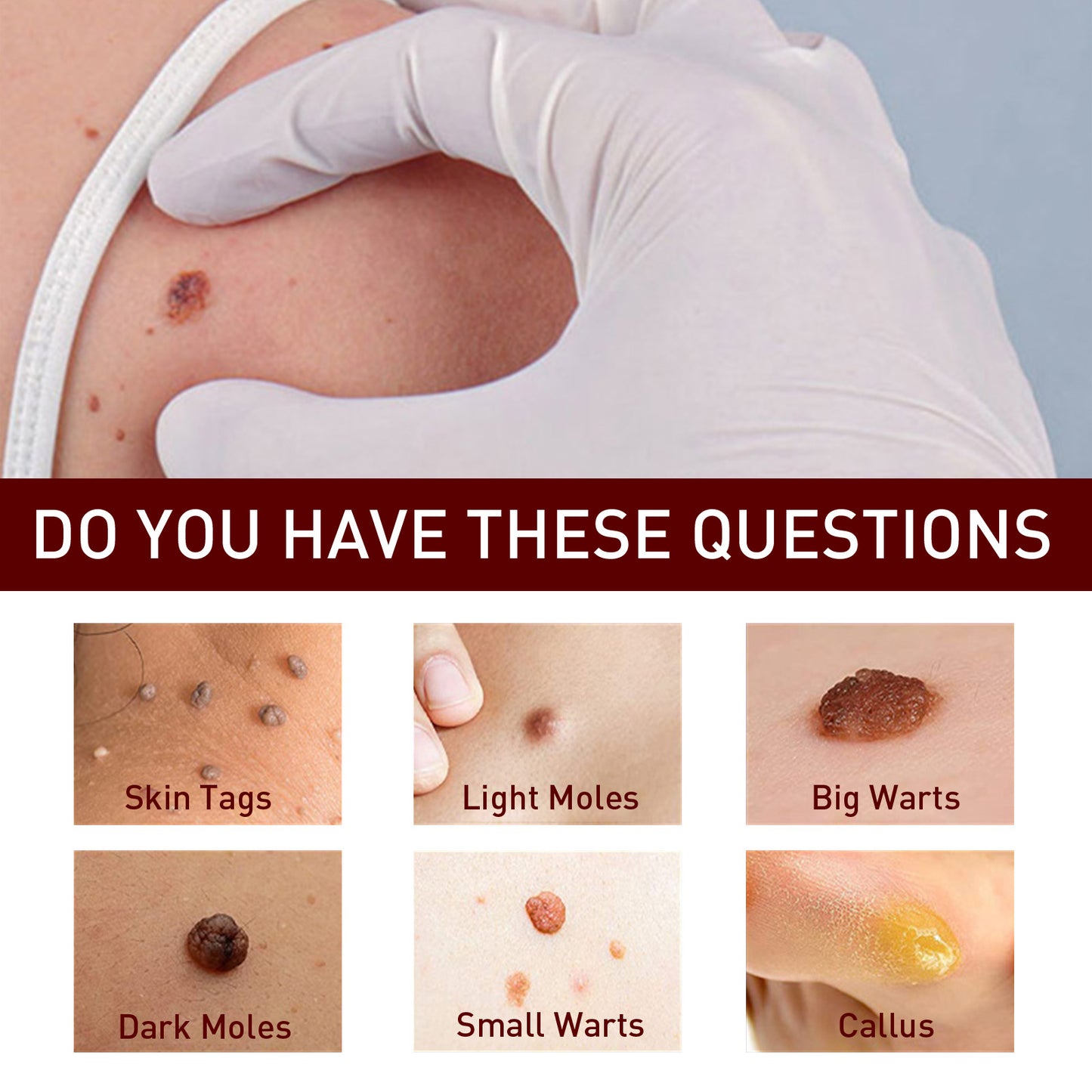 Jaysuing Skin Wart Care Pen Smooth Body Skin Gentle Cleansing Skin Label Care Solution Pen