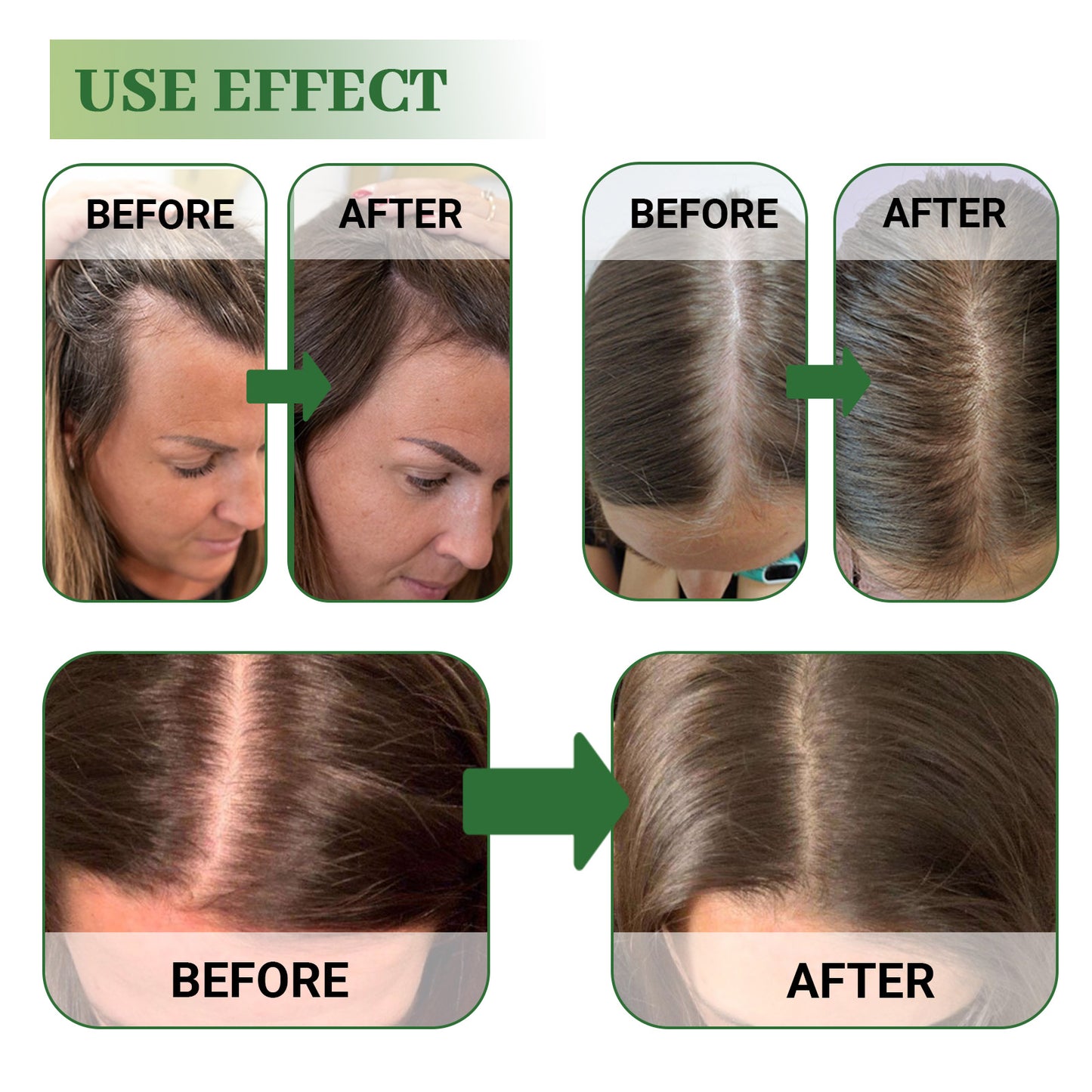 Hoegoa Rosemary Hair Treatment Oil Thick hair, smooth hair, dry and damaged hair care