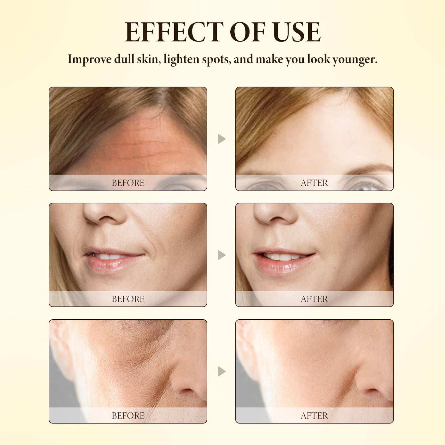 OUHOE Bee Venom Firming Cream Gentle Moisturizing Hydrating Nourishing Firming Skin Care Rejuvenating Cream