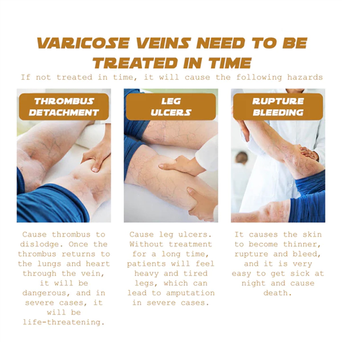 Ximonth Varicose Vein Massage Cream Relieve Soreness Leg Massage Varicose Earthworm Leg Vein Care Cream