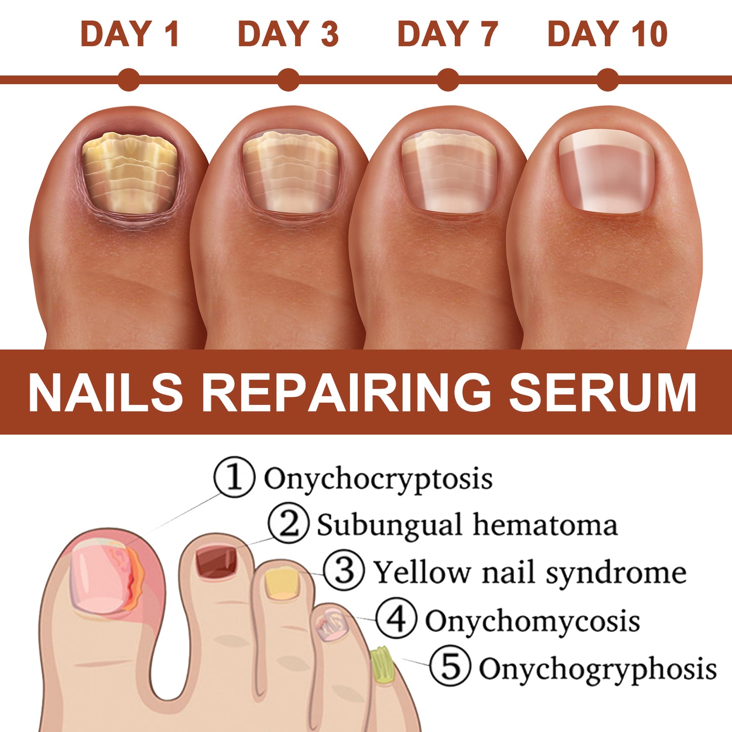 Jaysuing 7Nail Care Essence Onychomycosis Hand and Foot Nail Nutritional Cleansing Care Essence