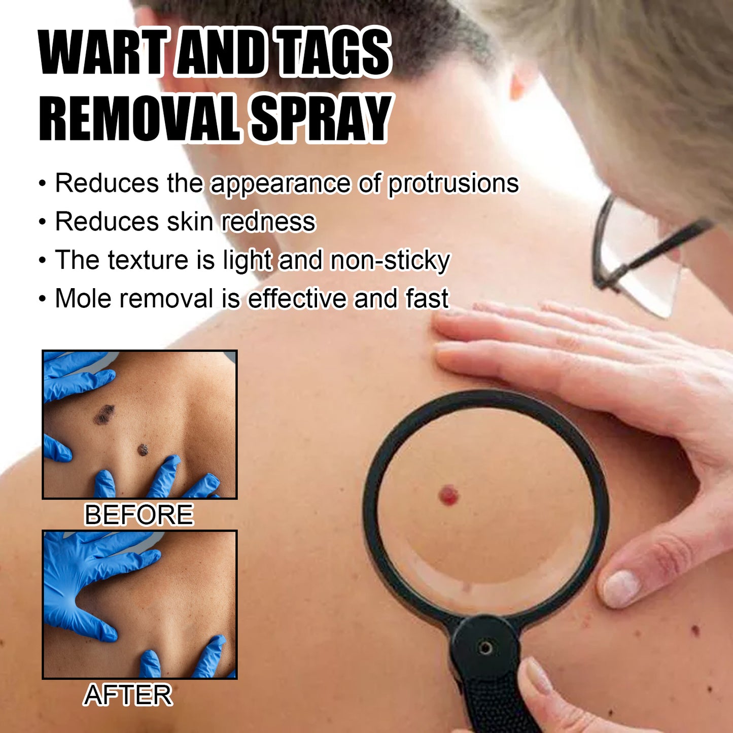 Ximonth Bee Venom Wart Care Spray Clean and fade body moles, smooth skin, and repair spray