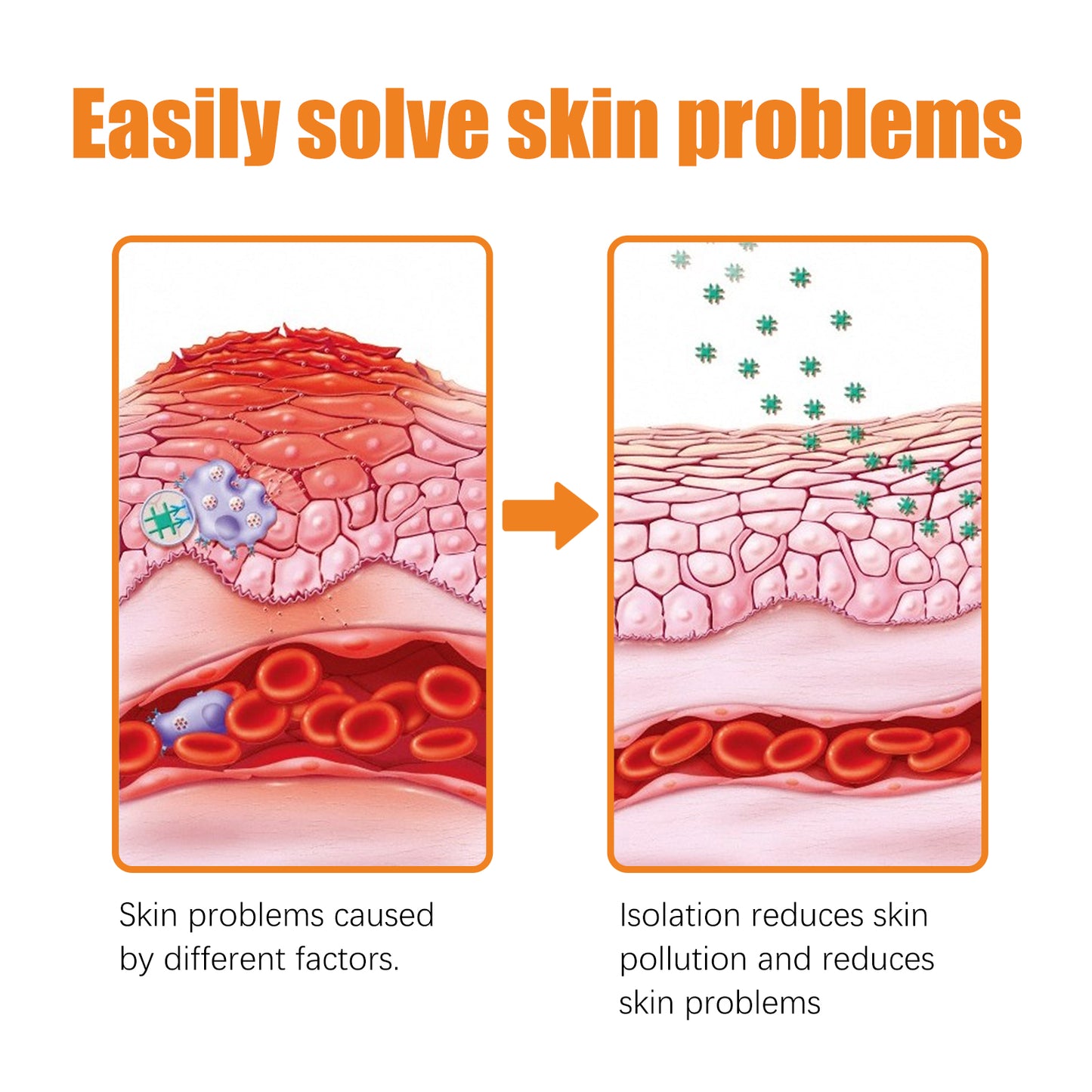 South Moon Skin Repair Cream Relieve itchy skin, repair hand and foot fungus, moisturize skin care cream