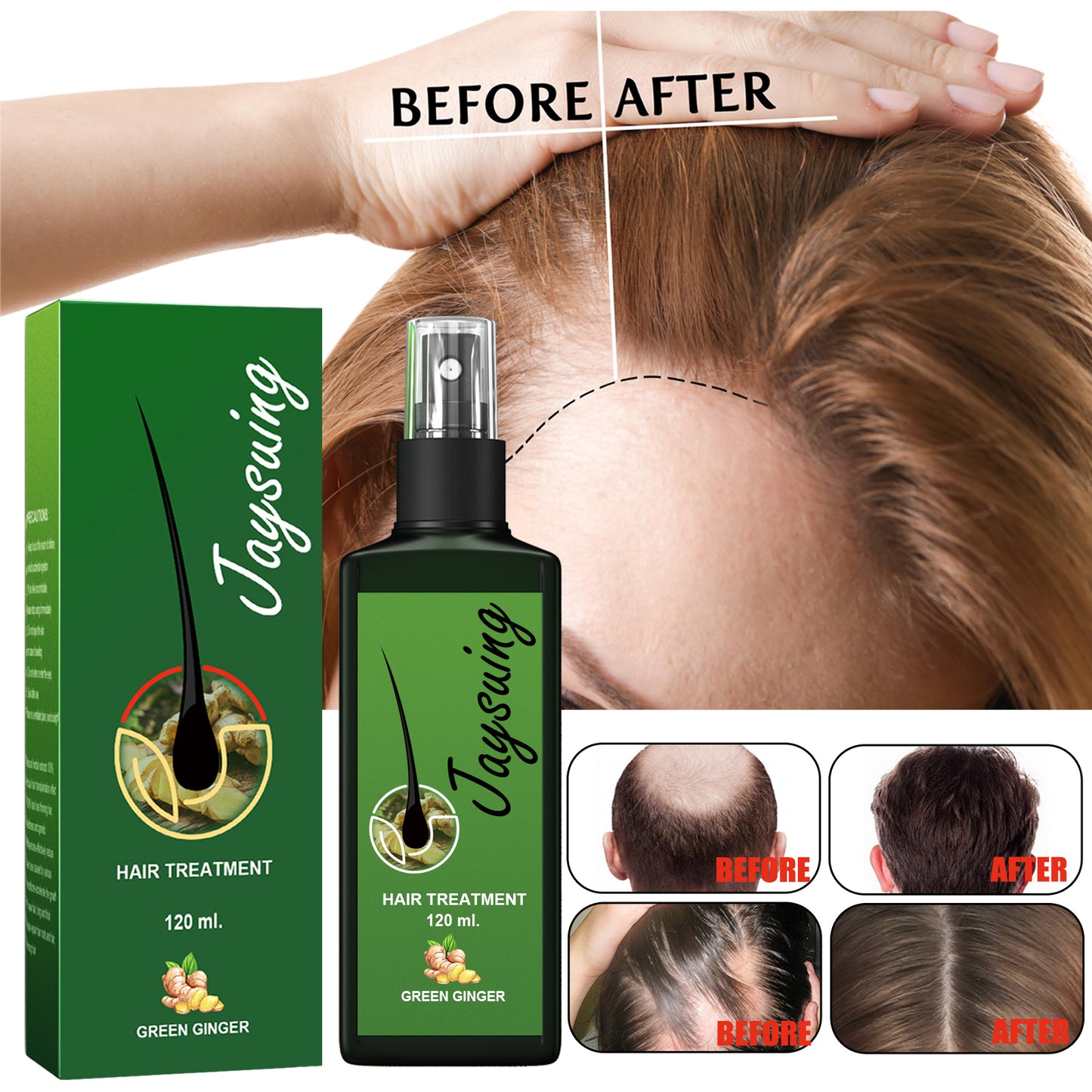 Jaysuing Hair Care Solution Gentle Nourishing Massage Scalp Moisturizing Smooth Hair Care Spray