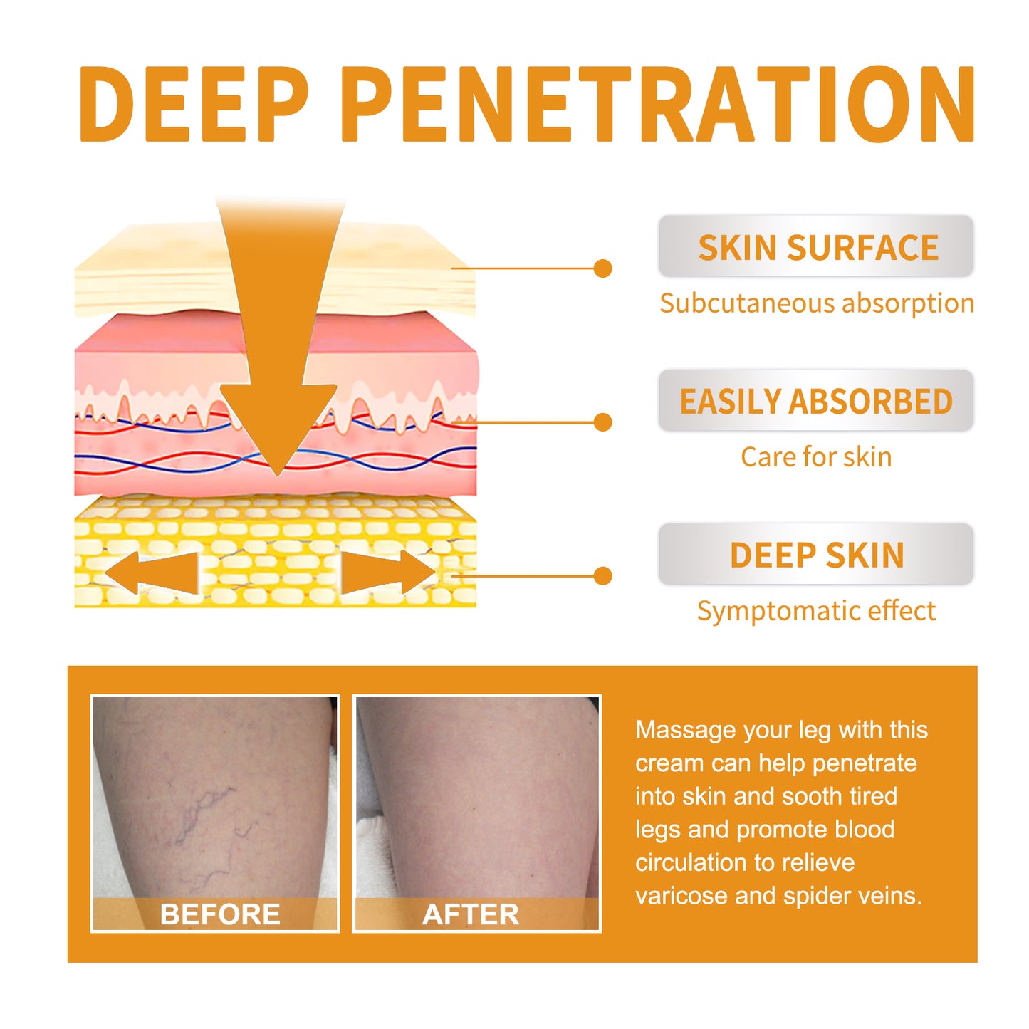 EELHOE Vitamin k Frost Skin Care Relieve Leg Soreness Swelling Earthworm Leg Vein Massage Care Cream