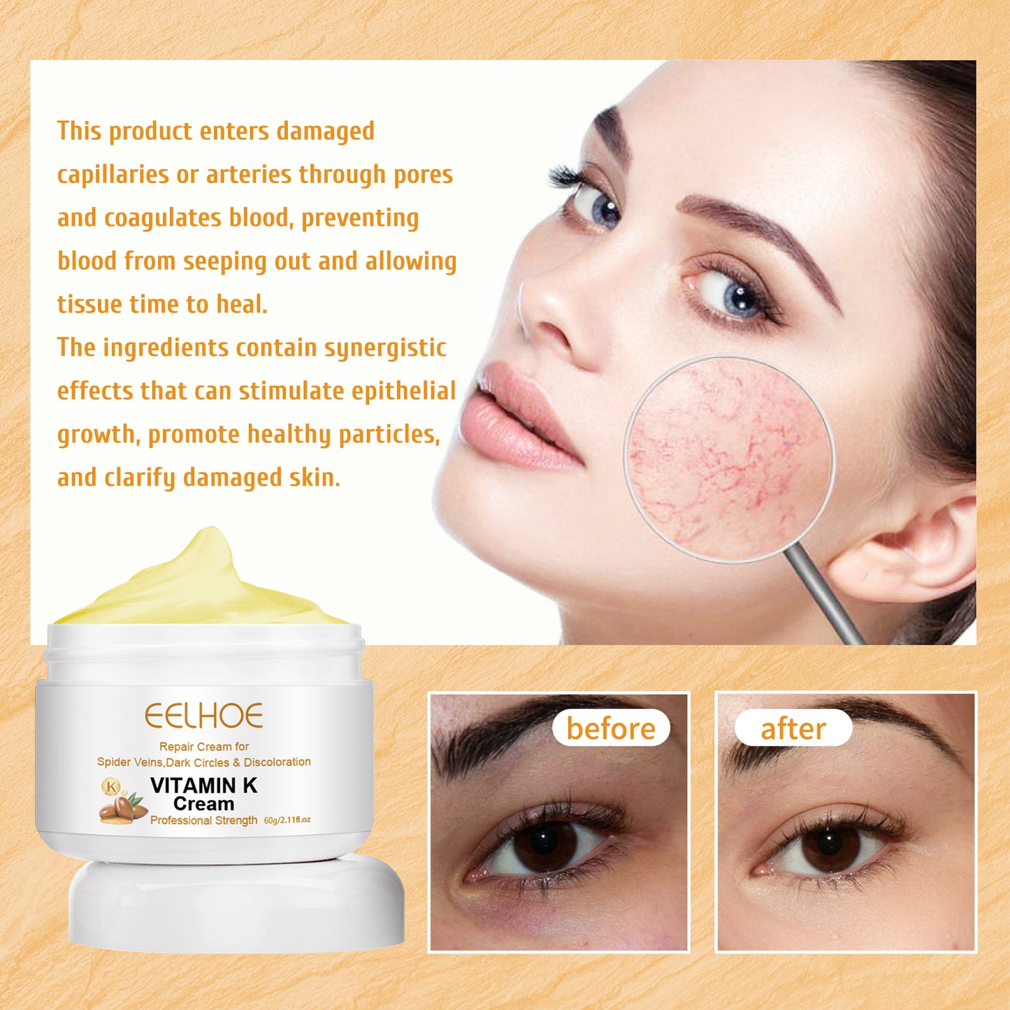 EELHOE Vitamin k Frost Skin Care Relieve Leg Soreness Swelling Earthworm Leg Vein Massage Care Cream