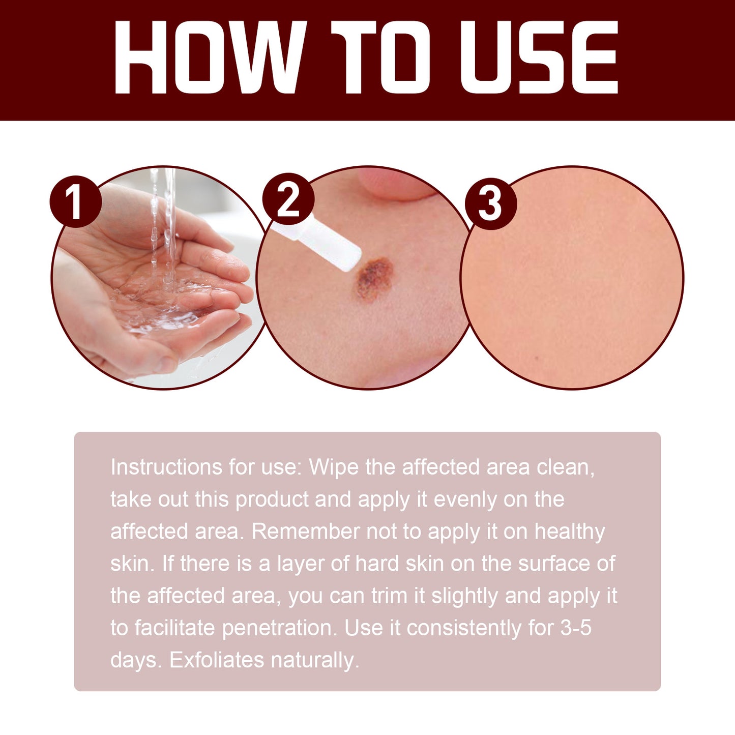 Jaysuing Skin Wart Care Pen Smooth Body Skin Gentle Cleansing Skin Label Care Solution Pen