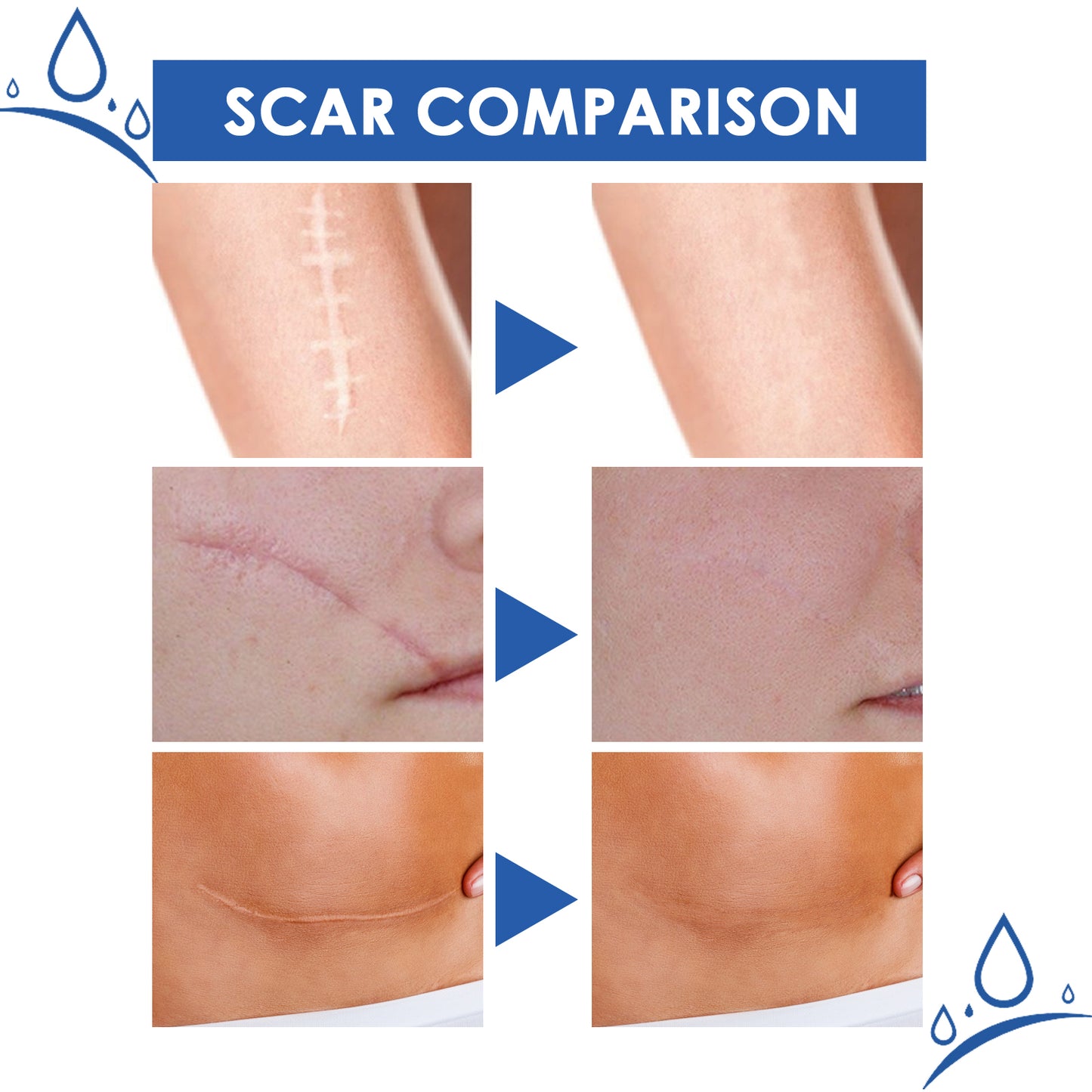 Jaysuing Scar Cream Scar Smoothing and Firming Skin Repair Cream