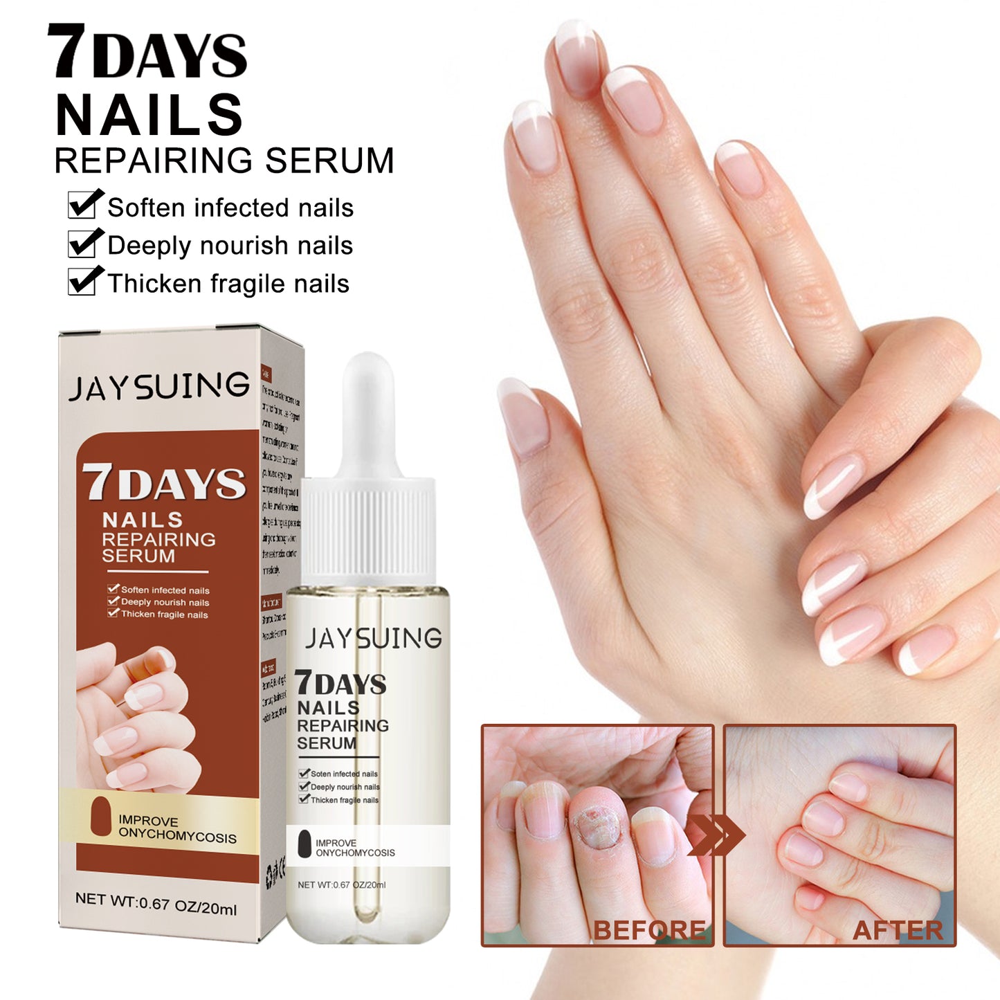 Jaysuing 7Nail Care Essence Onychomycosis Hand and Foot Nail Nutritional Cleansing Care Essence