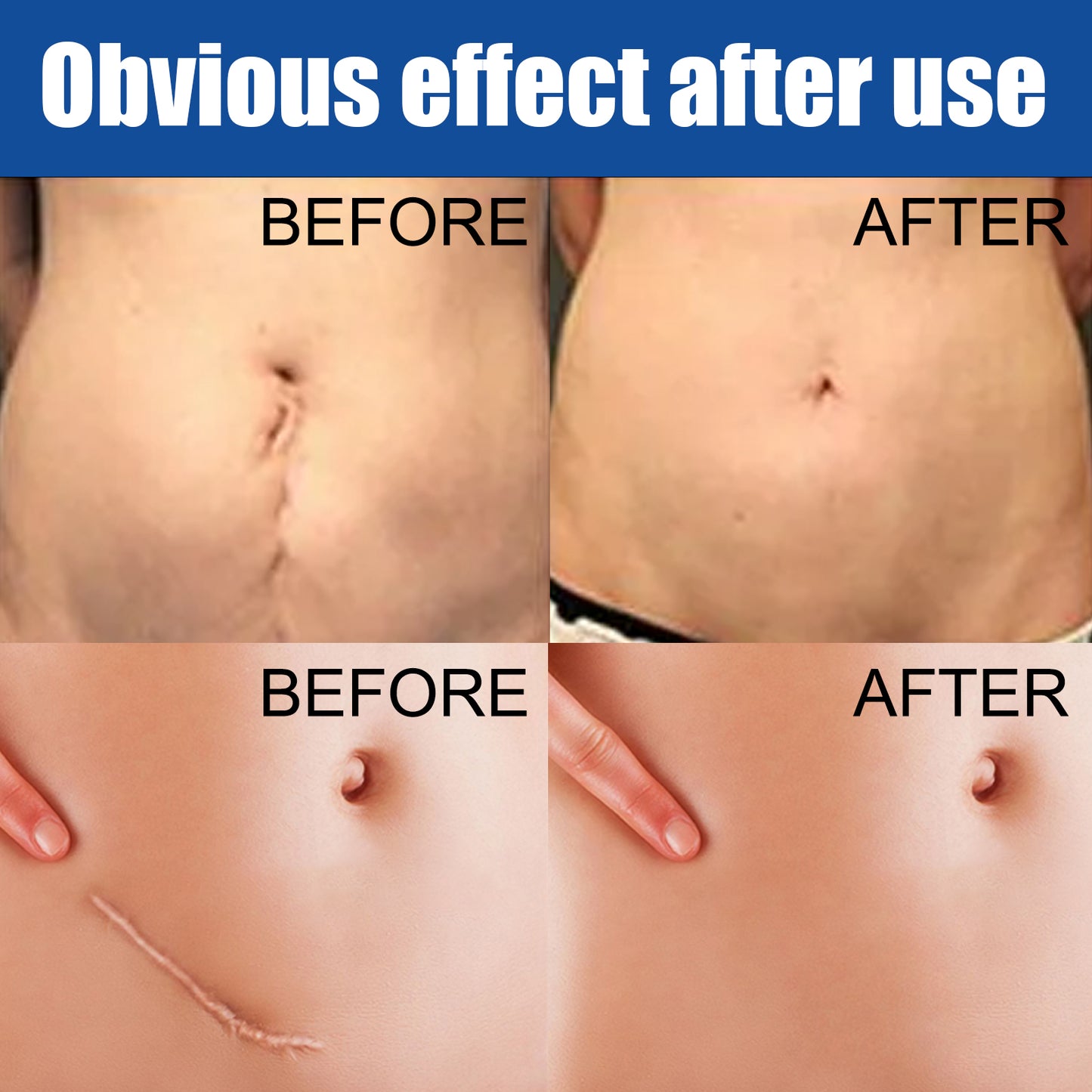 EELHOE Skin Care Cream Gentle Care External Body Care Moisturizing Smoothing Skin Care Application Cream