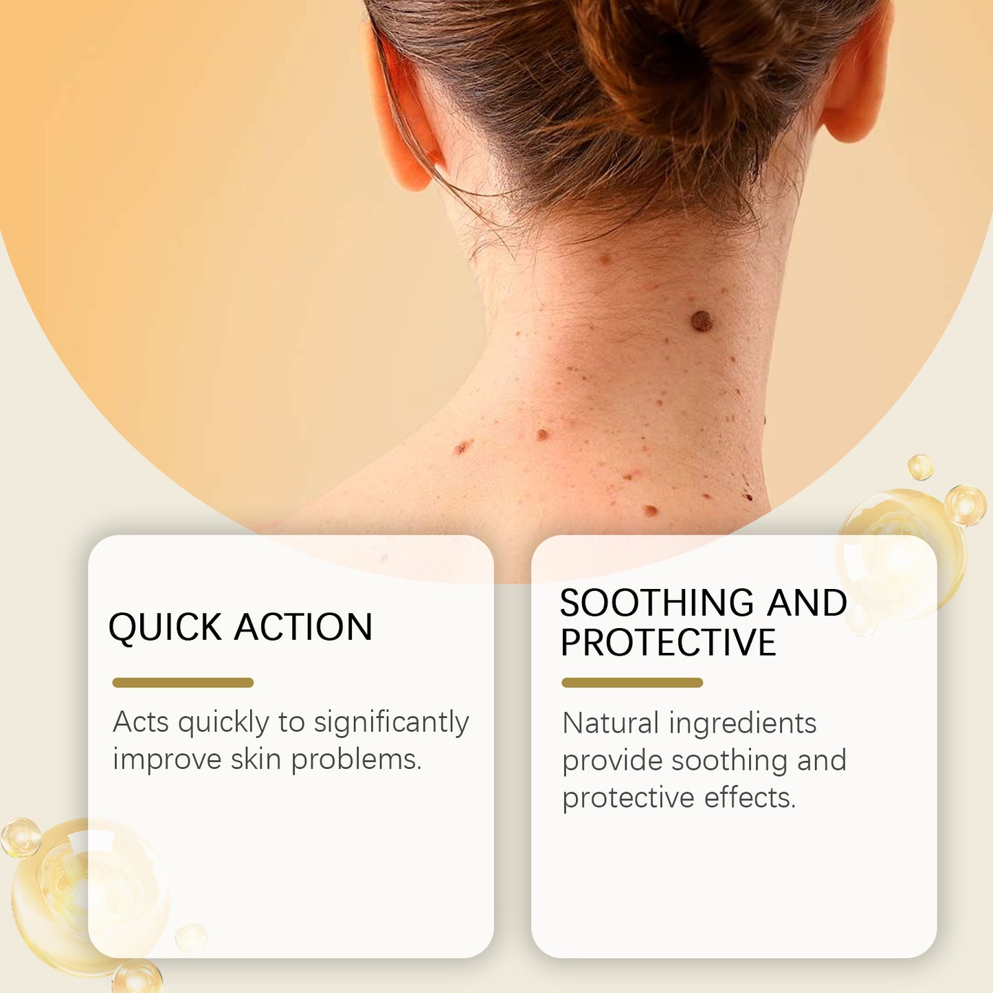 Ximonth Keyou Mole Cream Gentle Cleansing Skin Smooth Skin Moisturizing Repair Skin Care Cream