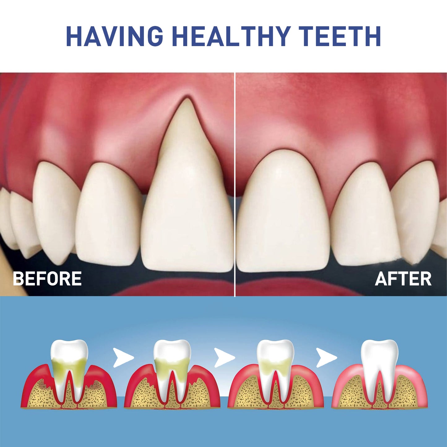 WestMonth Gum Care Gel Relieve gum swelling and pain, clean plaque stains, whiten teeth gel