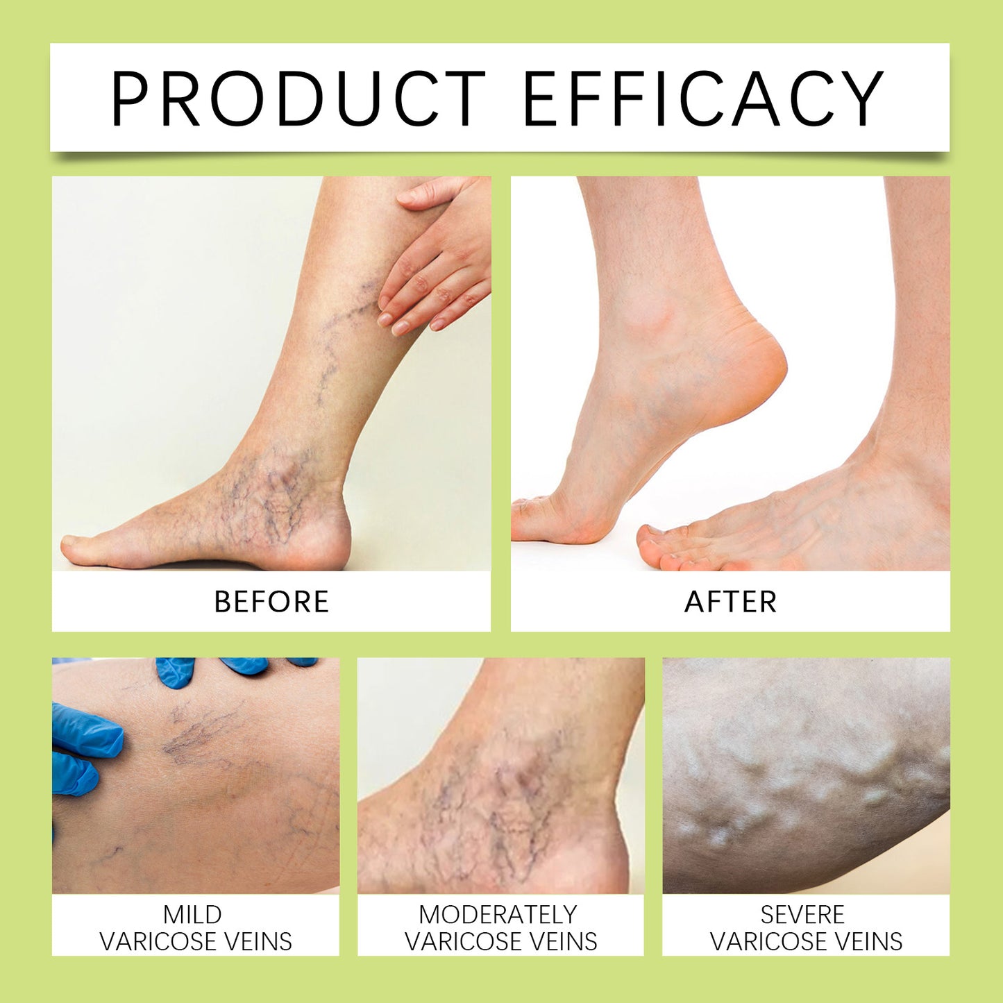 Ximonth Leg Care Cream Gentle Care Relief Leg Discomfort Massage Daily External Use Care Cream