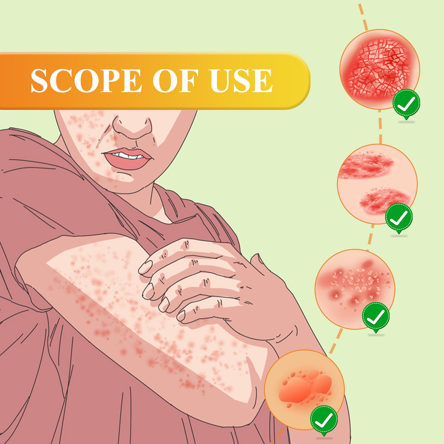 South Moon Skin Repair Cream Relieve itchy skin, repair hand and foot fungus, moisturize skin care cream