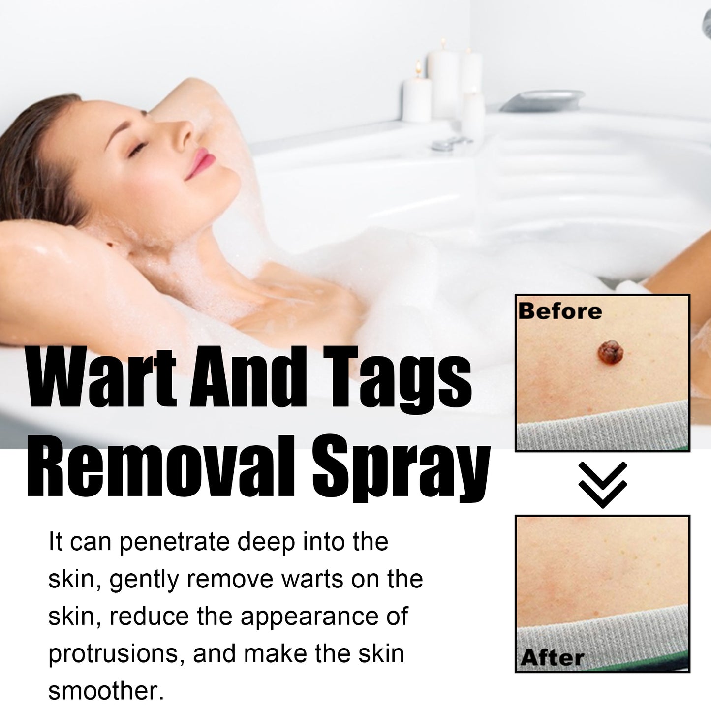 Ximonth Bee Venom Wart Care Spray Clean and fade body moles, smooth skin, and repair spray