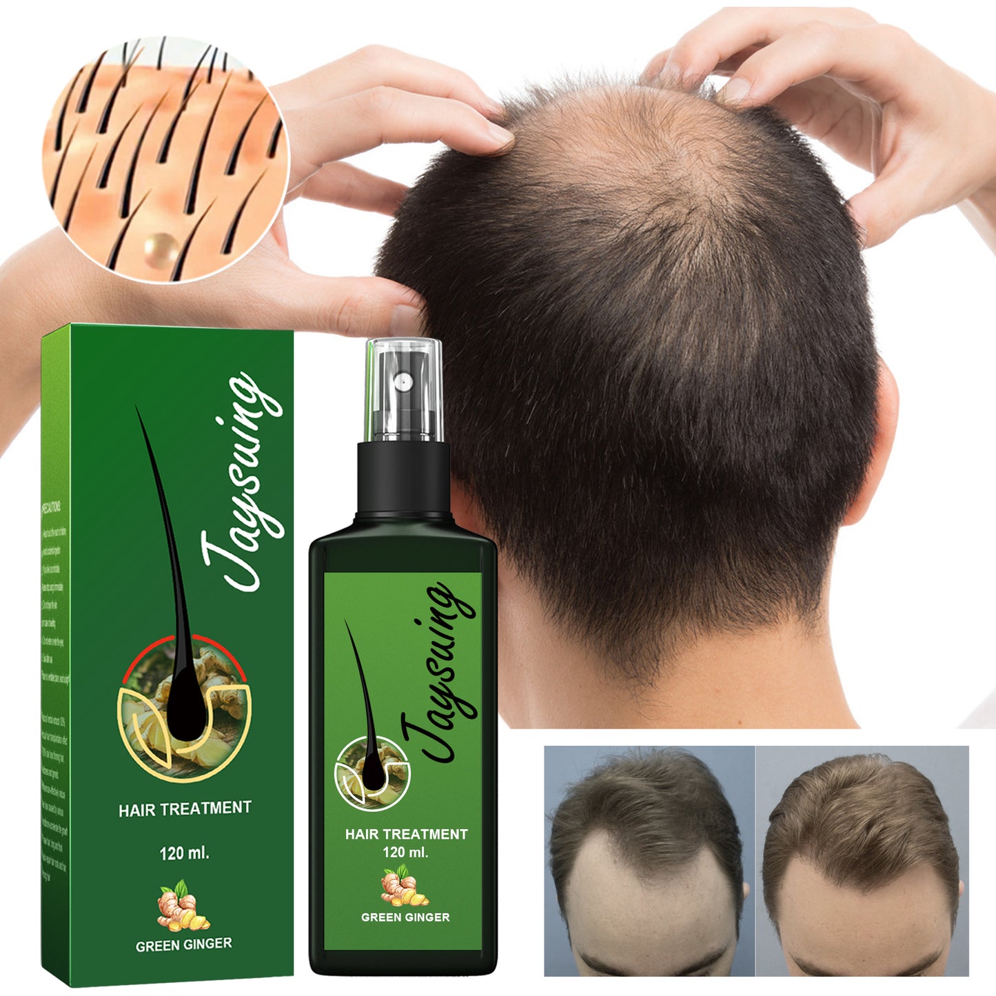 Jaysuing Hair Care Solution Gentle Nourishing Massage Scalp Moisturizing Smooth Hair Care Spray