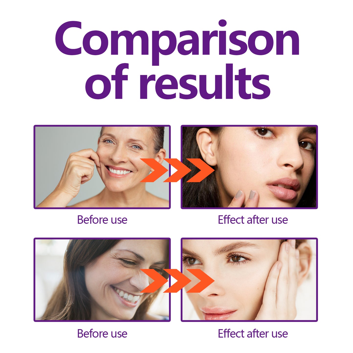 Hoygi Facial Lifting and Firming Cream Reduce Facial Fine Lines and Nasolabial Folds, Gentle Hydrating and Moisturizing Cream