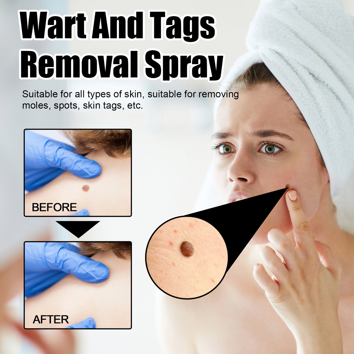 Ximonth Bee Venom Wart Care Spray Clean and fade body moles, smooth skin, and repair spray