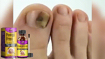 Ximonth Bee Venom Onychomycosis Treatment Solution Hand and Foot Nail Fungus Cleansing Nutritional Repair Brightening Thickening