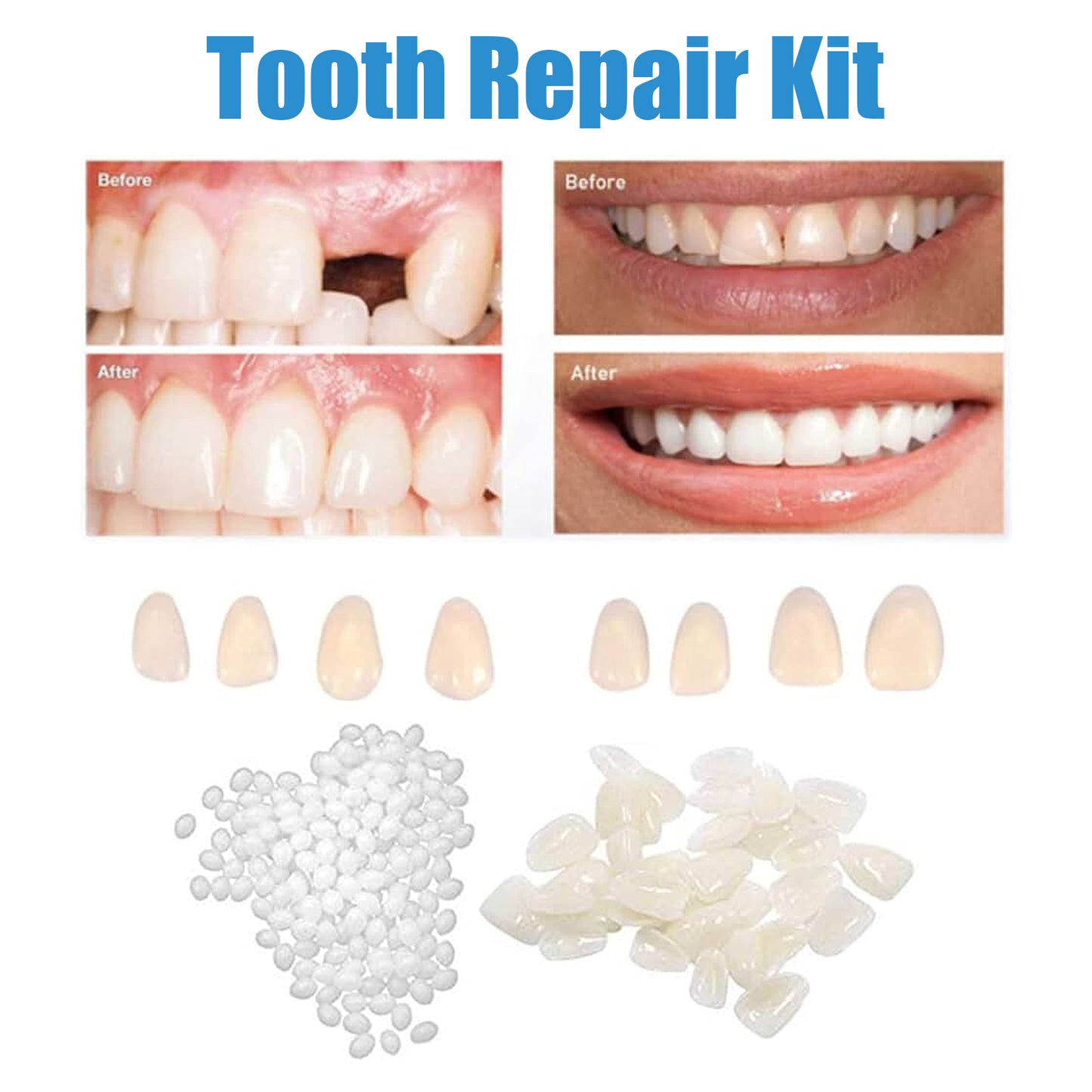 Jaysuing Temporary Tooth Repair Kit Halloween Makeup Teeth Modification Dentures Fill Teeth Gaps Cavities Teeth Gel
