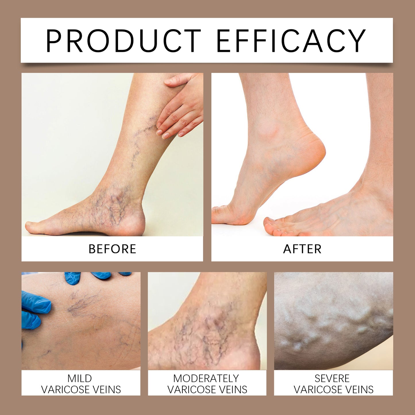 Ximonth Leg Neck Cream Moisturizing and Moisturizing Leg Skin Gentle Care Massage Leg Care Cream