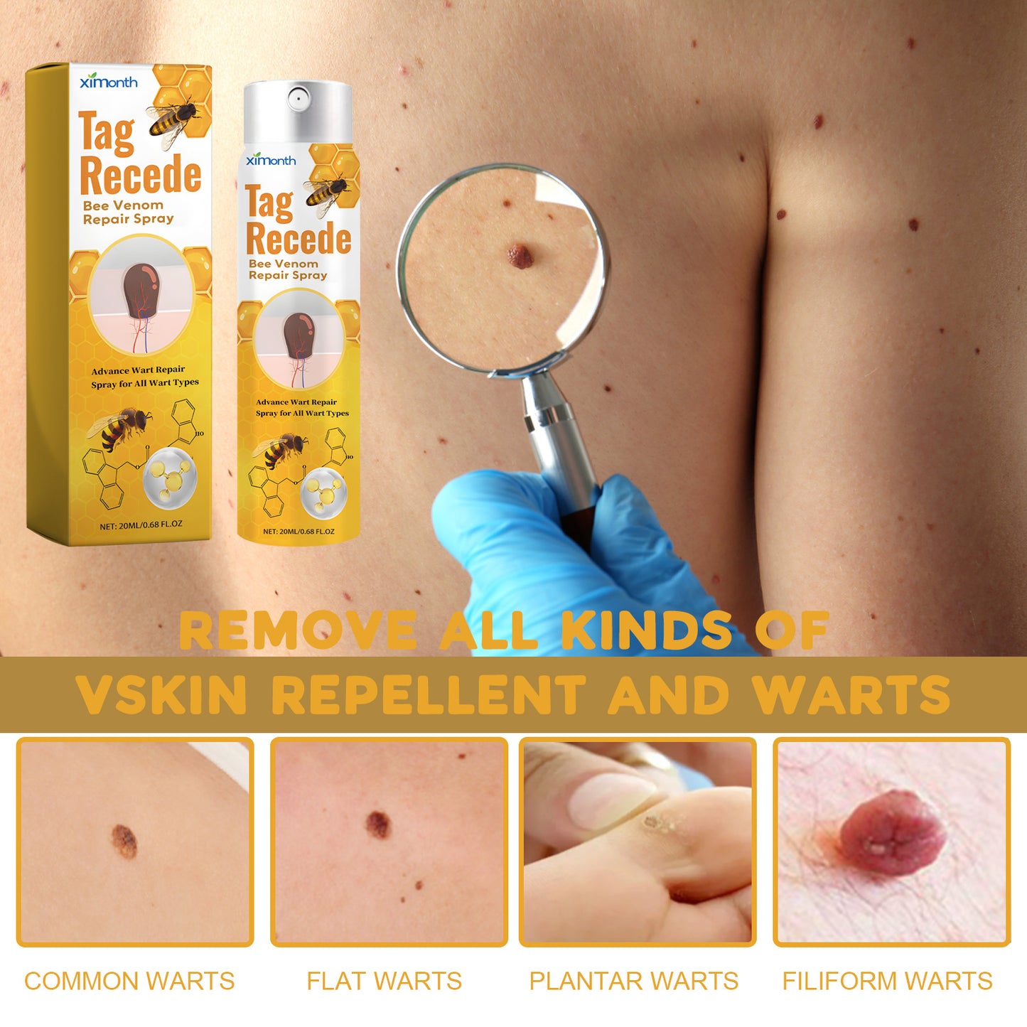 Ximonth Bee Venom Wart Care Spray Improve Skin Texture, Repair Moles, Smooth Skin, Wart Removal Spray
