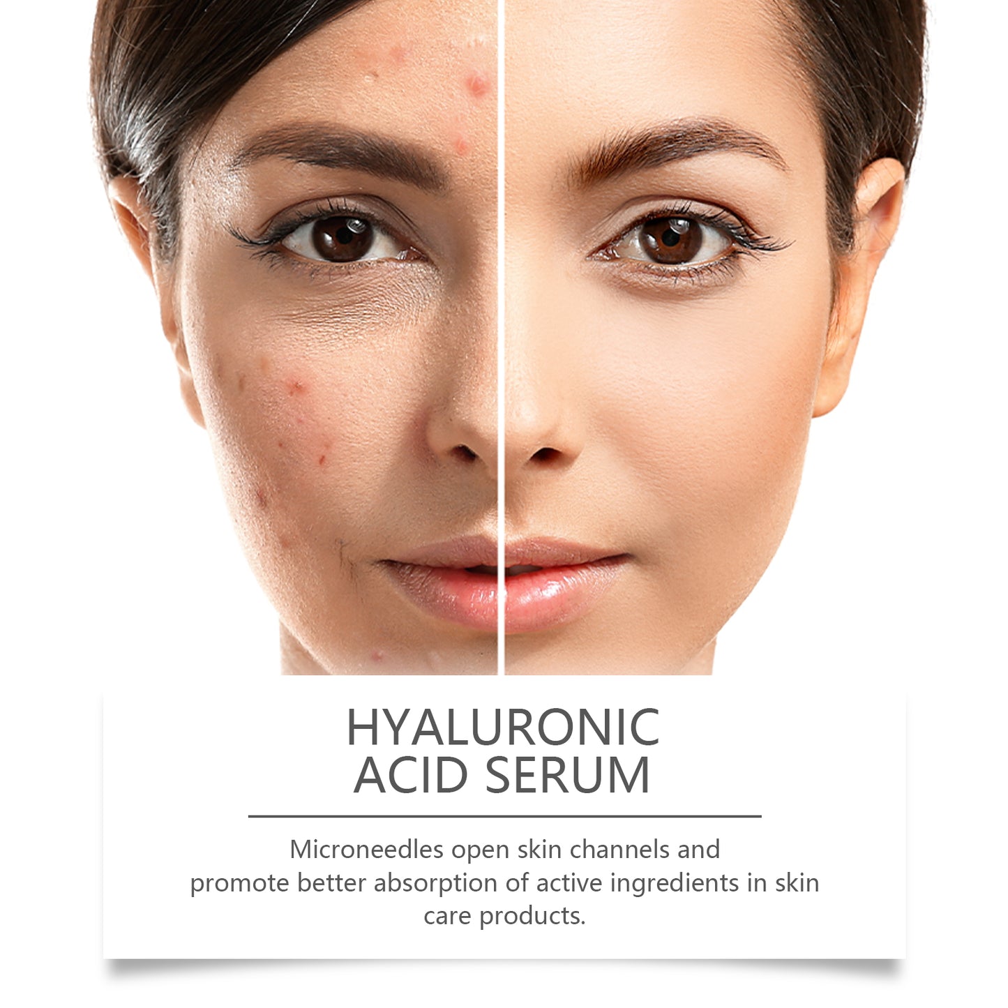 Hoygi Hyaluronic Acid Roller Serum Facial skin radiance improvement pore hydration