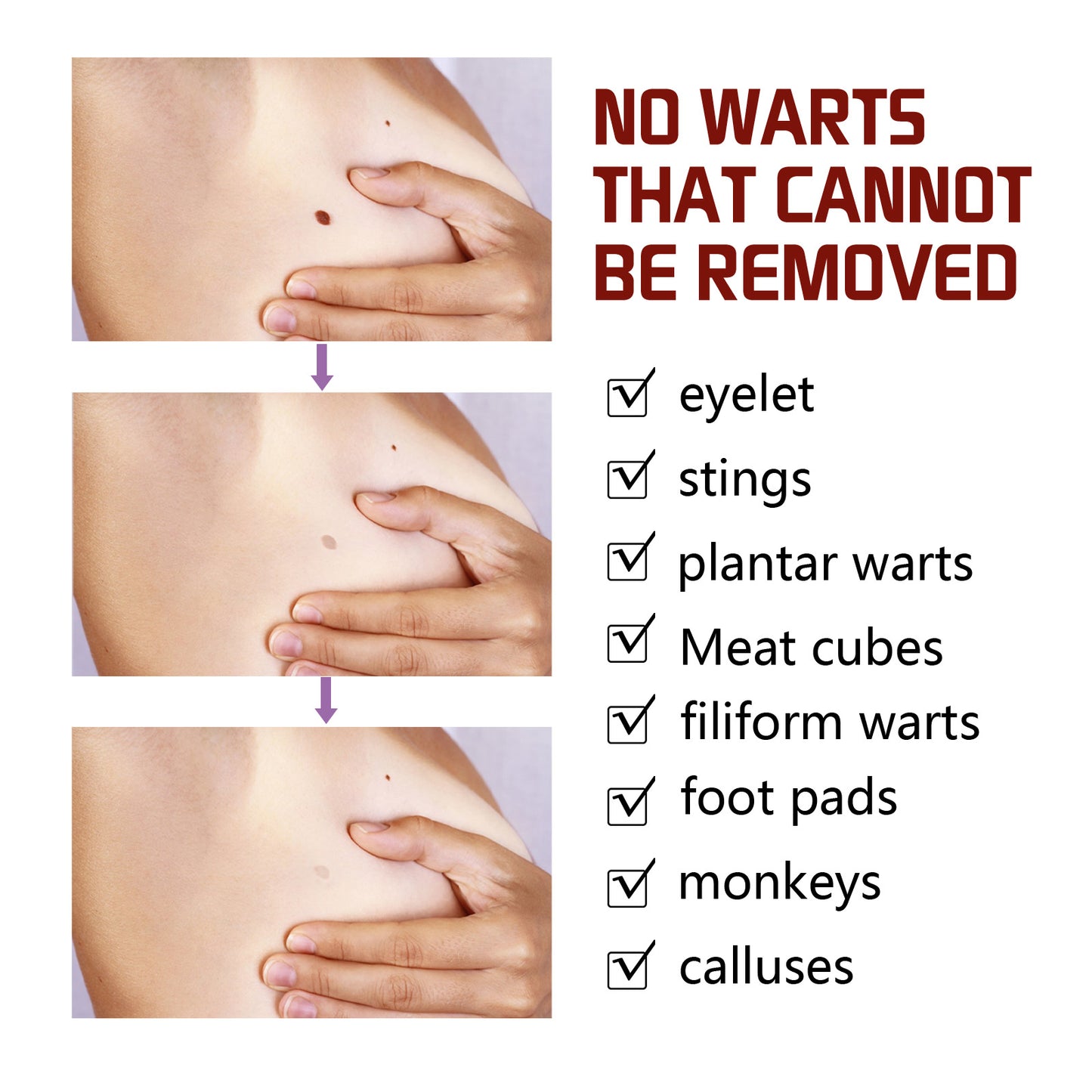 Jaysuing Skin Wart Care Pen Smooth Body Skin Gentle Cleansing Skin Label Care Solution Pen