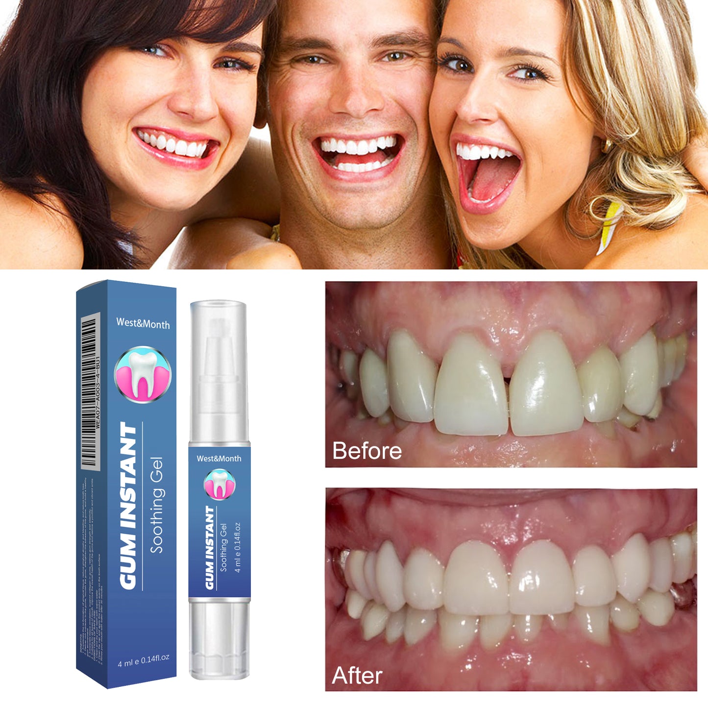 WestMonth Gum Care Gel Relieve gum swelling and pain, clean plaque stains, whiten teeth gel